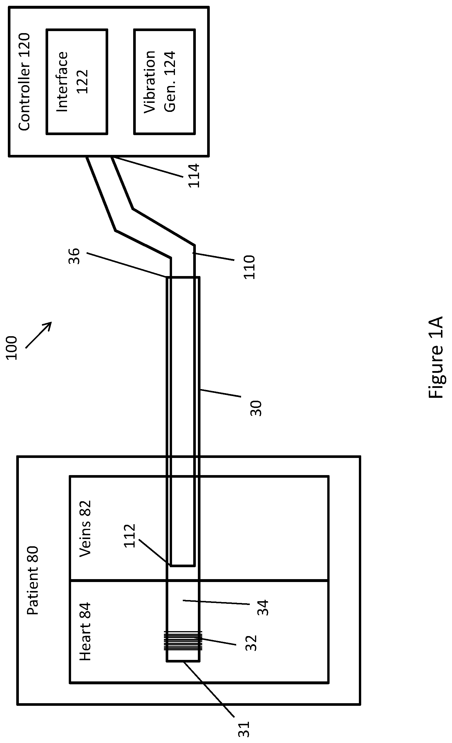 Patent US11771448 Figure 1 – System and method for lead extraction