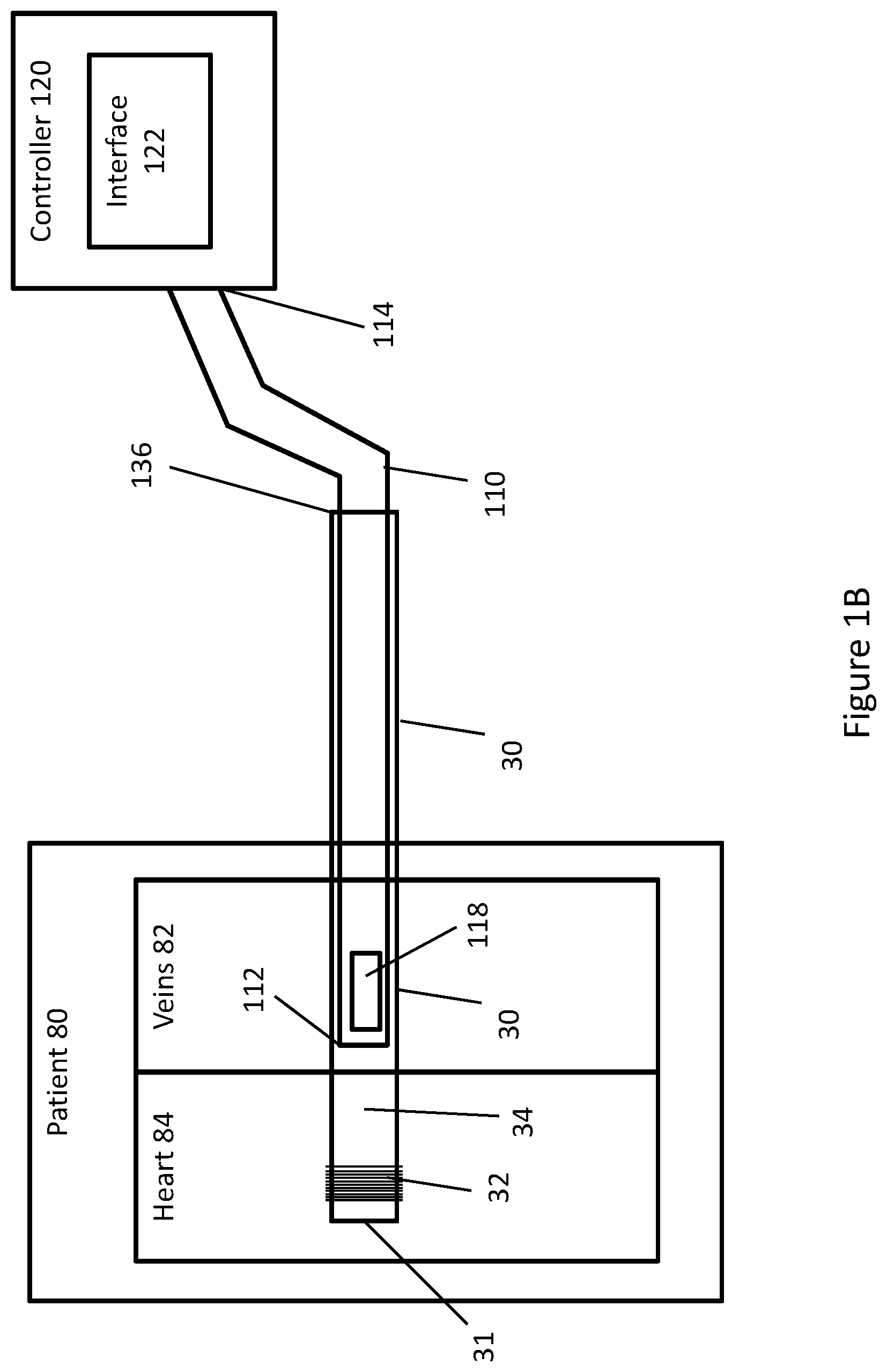 Patent US11771448 Figure 2 – System and method for lead extraction