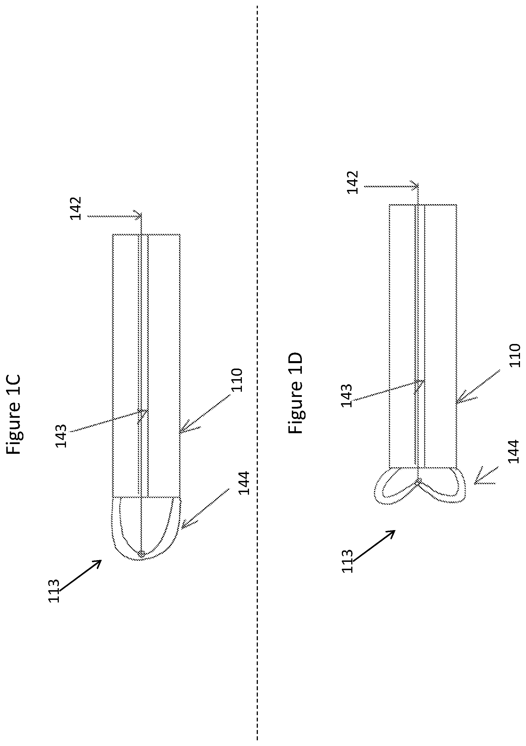Patent US11771448 Figure 3 – System and method for lead extraction