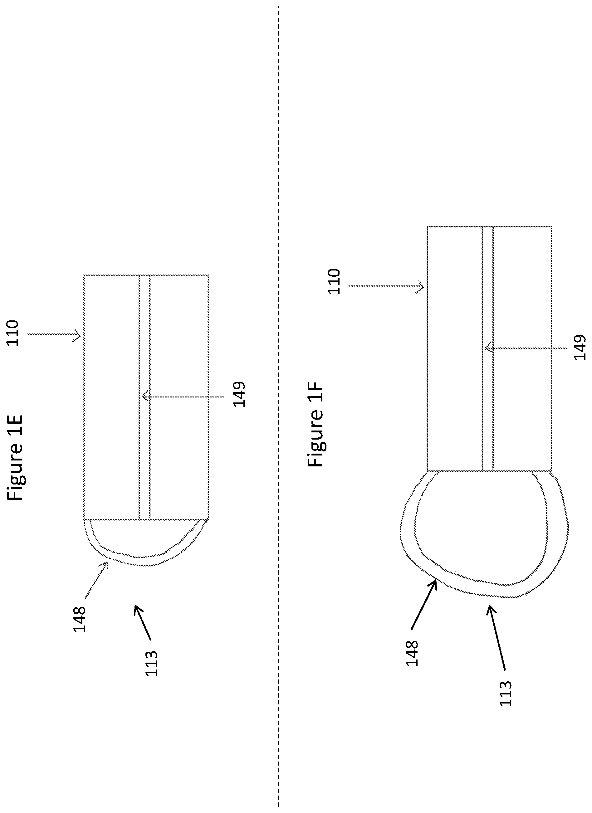 Patent US11771448 Figure 4 – System and method for lead extraction