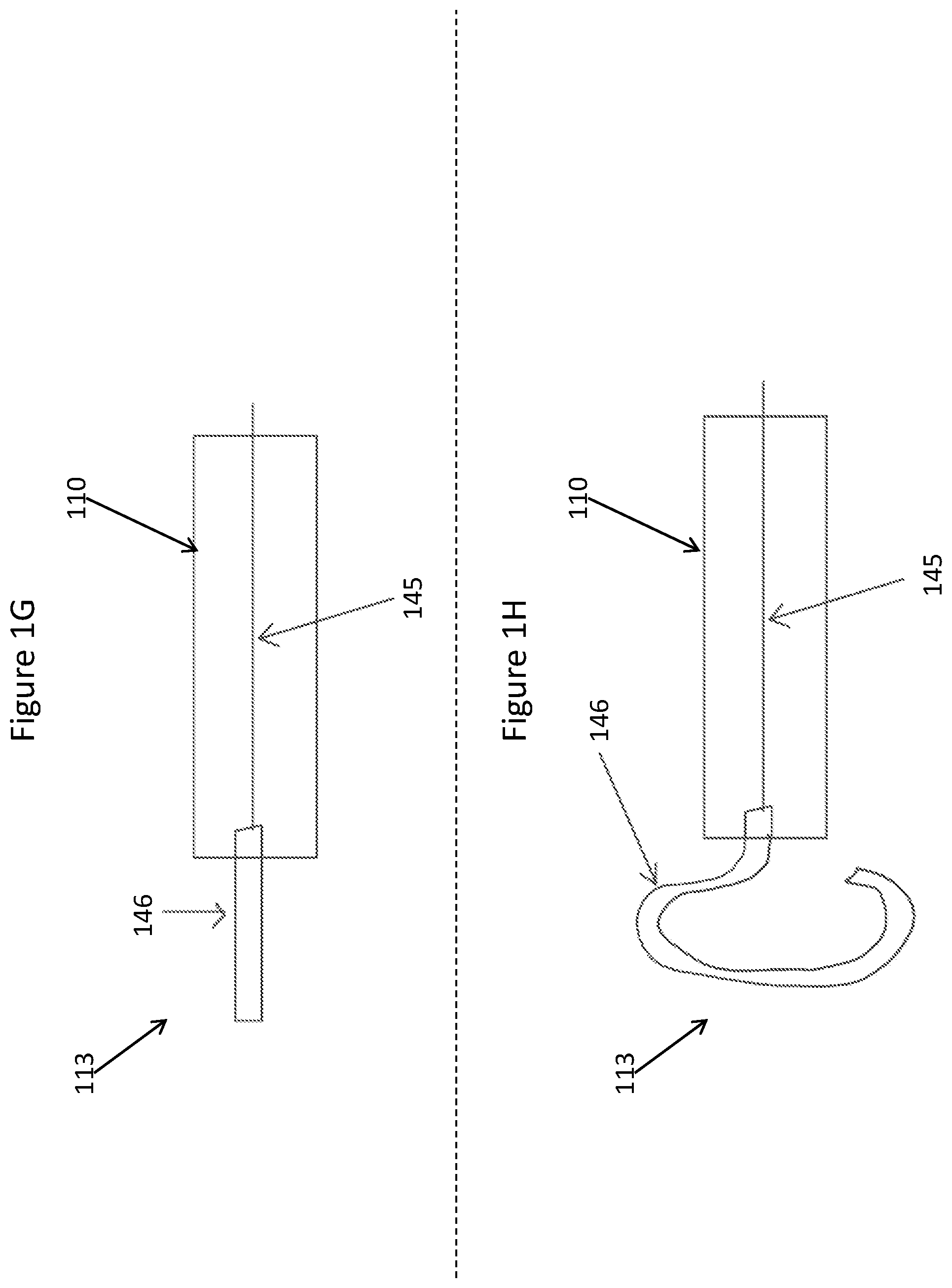 Patent US11771448 Figure 5 – System and method for lead extraction