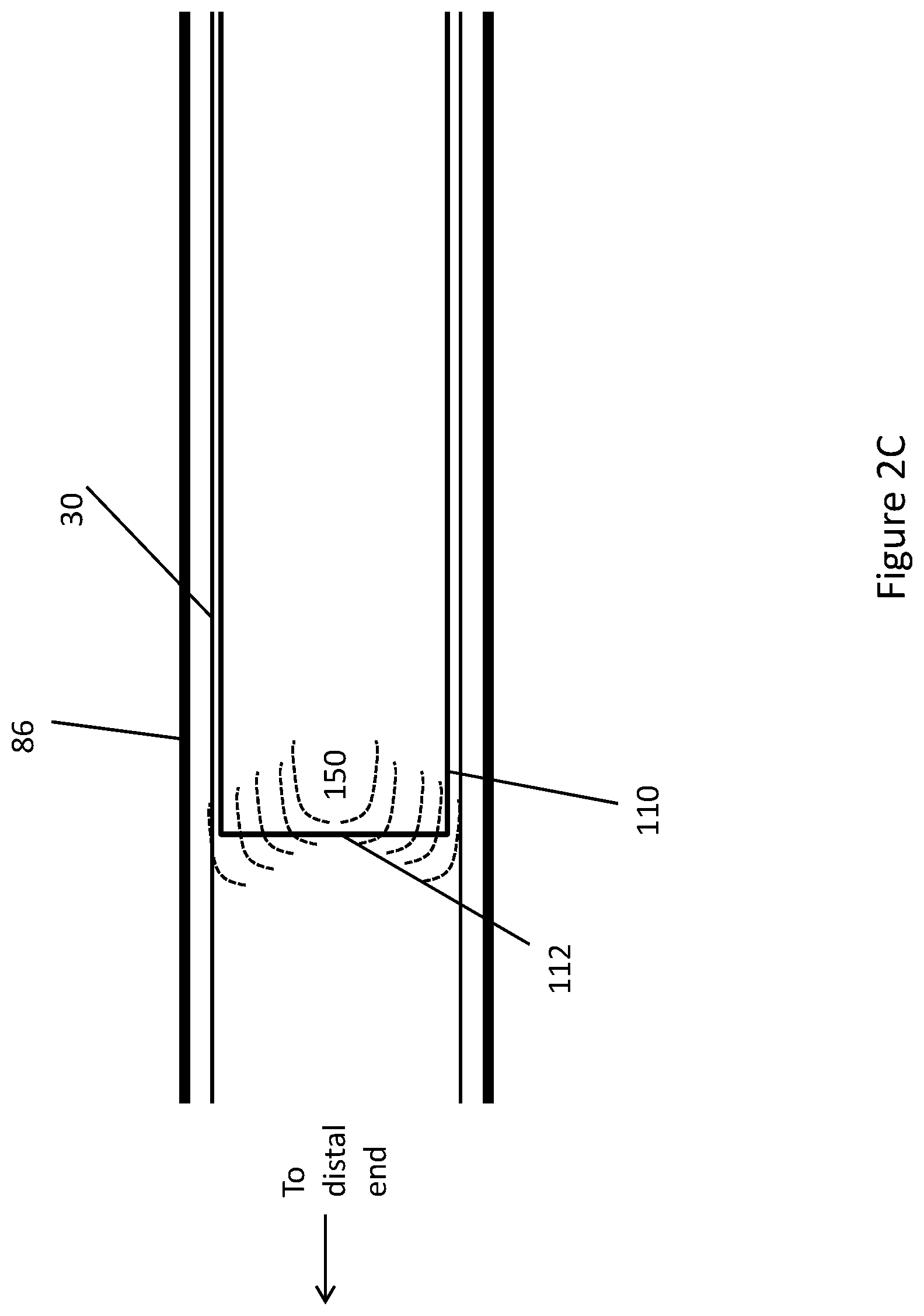 Patent US11771448 Figure 11 – System and method for lead extraction