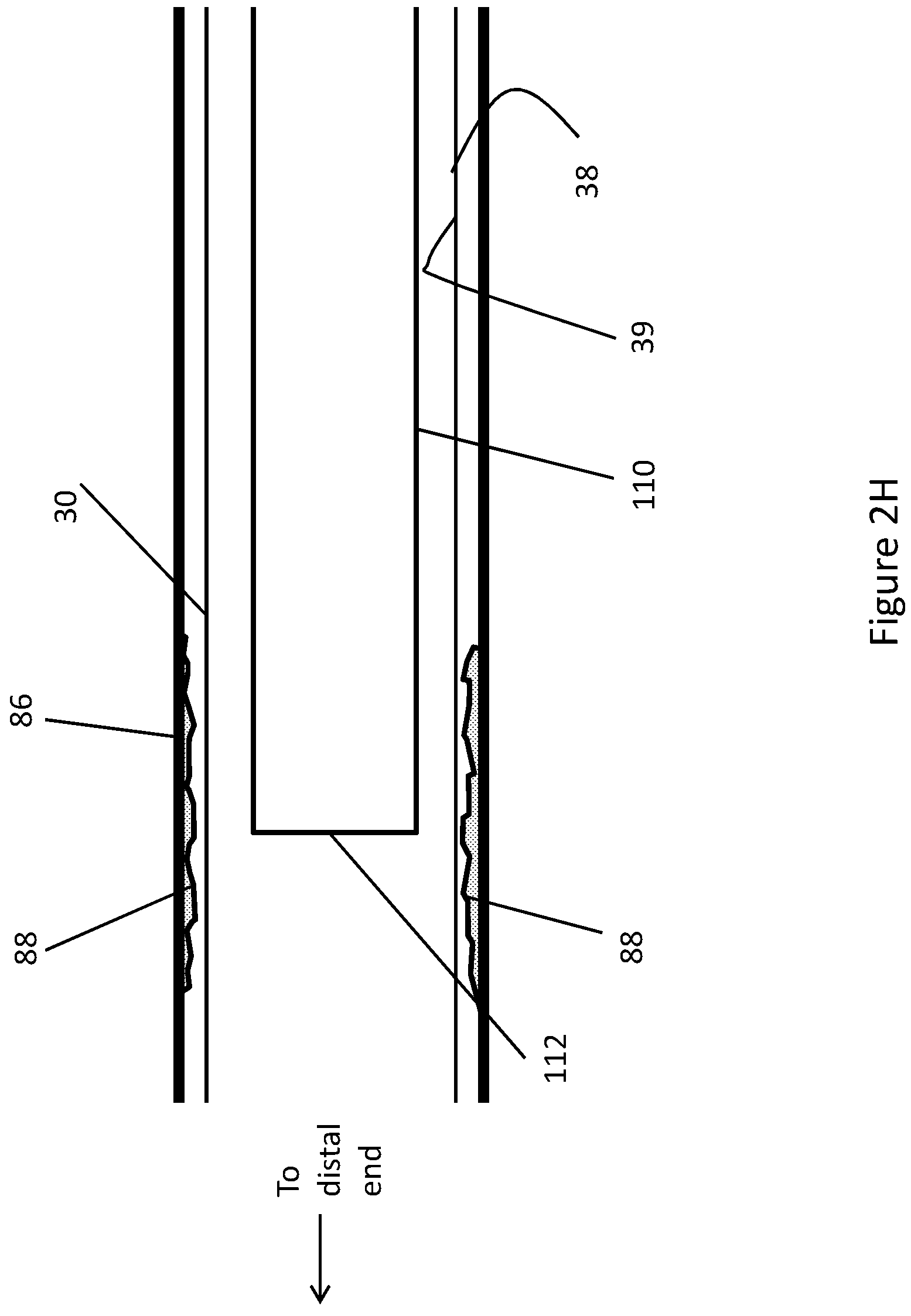 Patent US11771448 Figure 16 – System and method for lead extraction