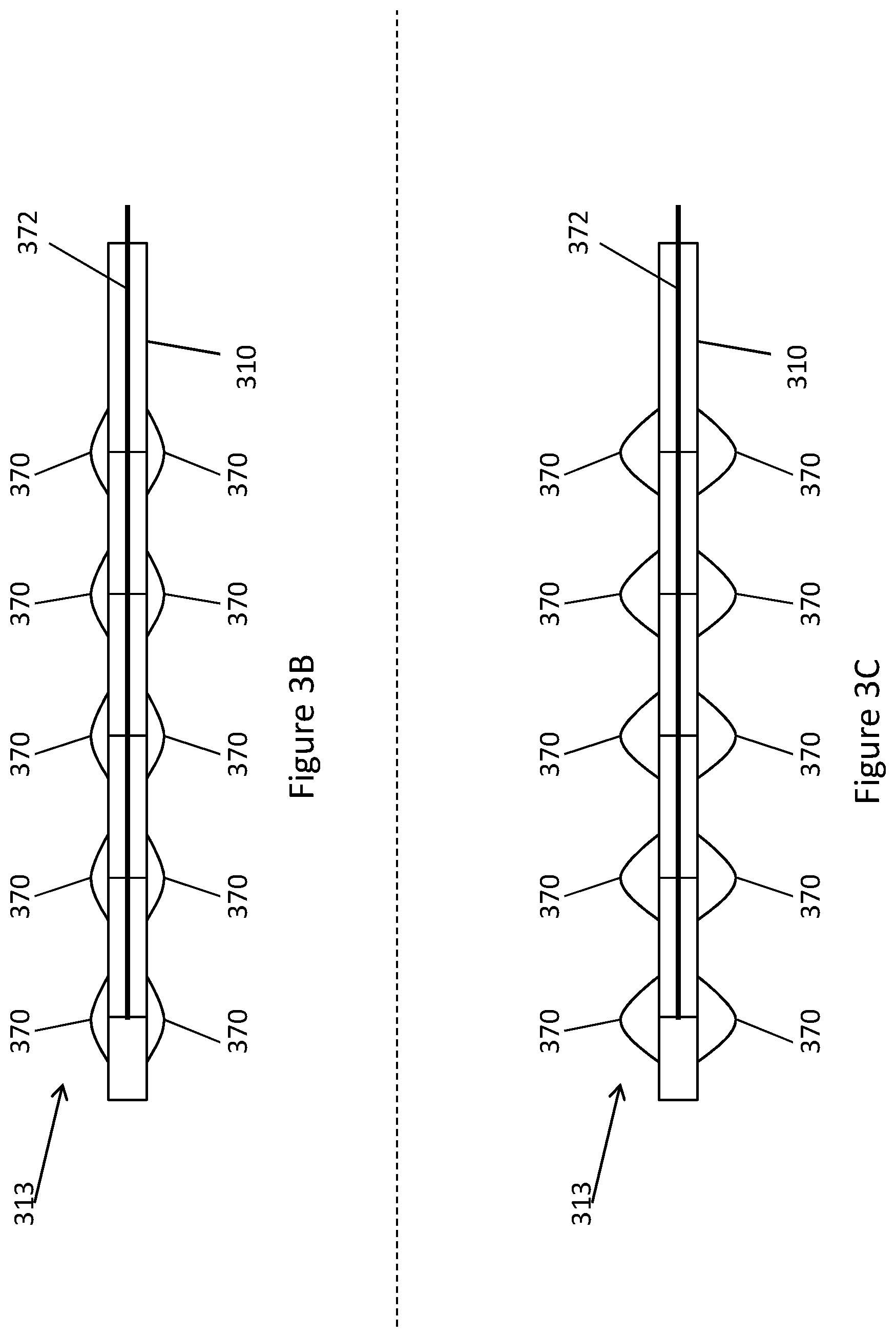 Patent US11771448 Figure 18 – System and method for lead extraction