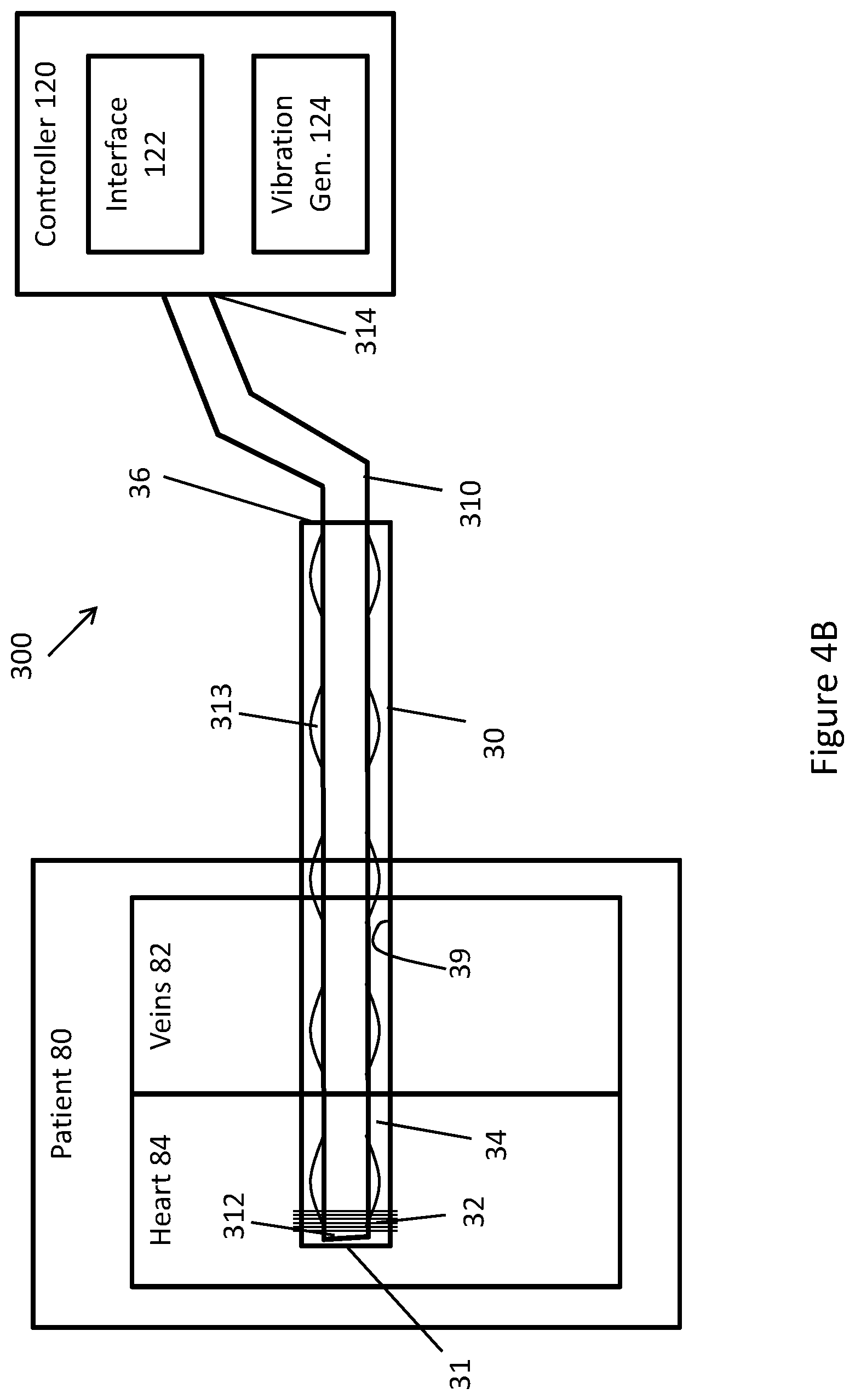 Patent US11771448 Figure 20 – System and method for lead extraction