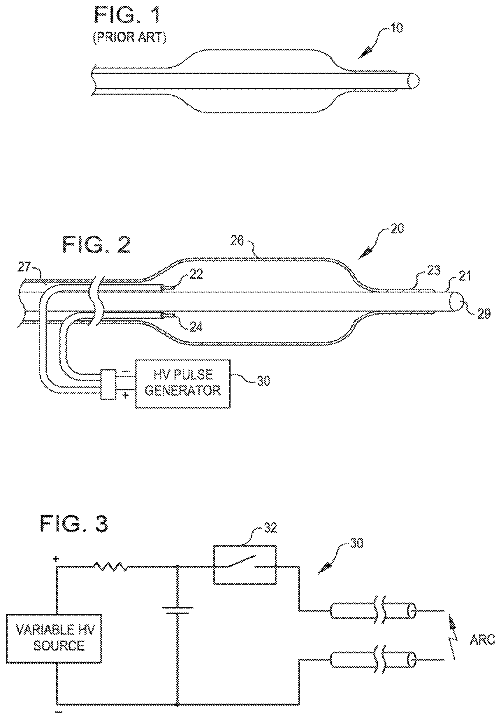 Patent US11771449 Figure 1 – Shockwave balloon catheter system