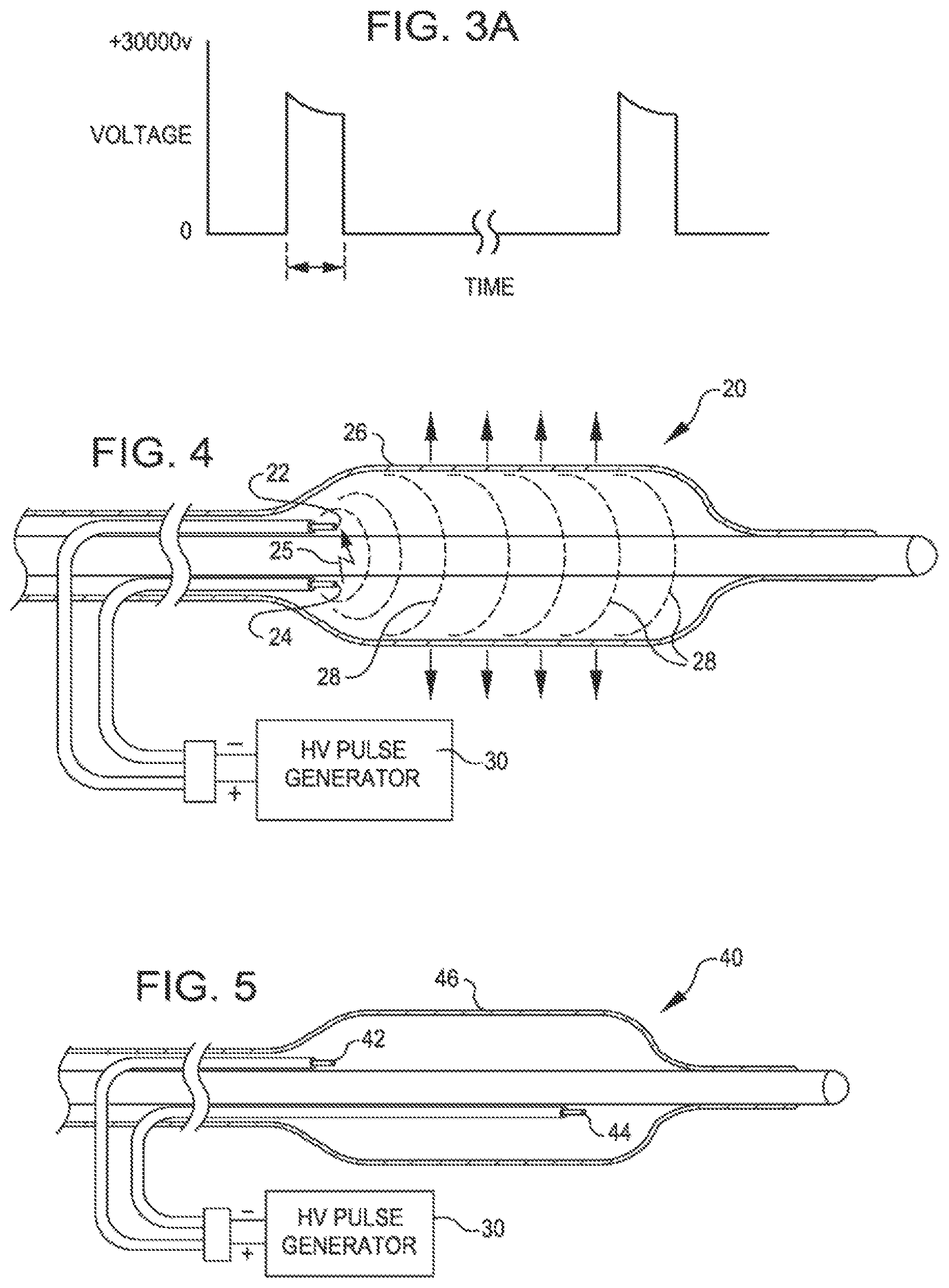 Patent US11771449 Figure 2 – Shockwave balloon catheter system