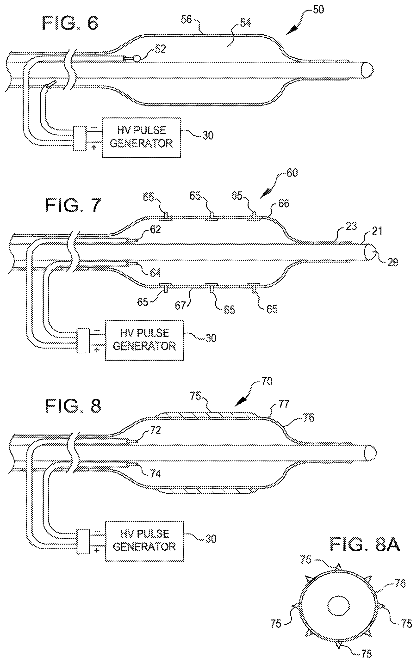 Patent US11771449 Figure 3 – Shockwave balloon catheter system