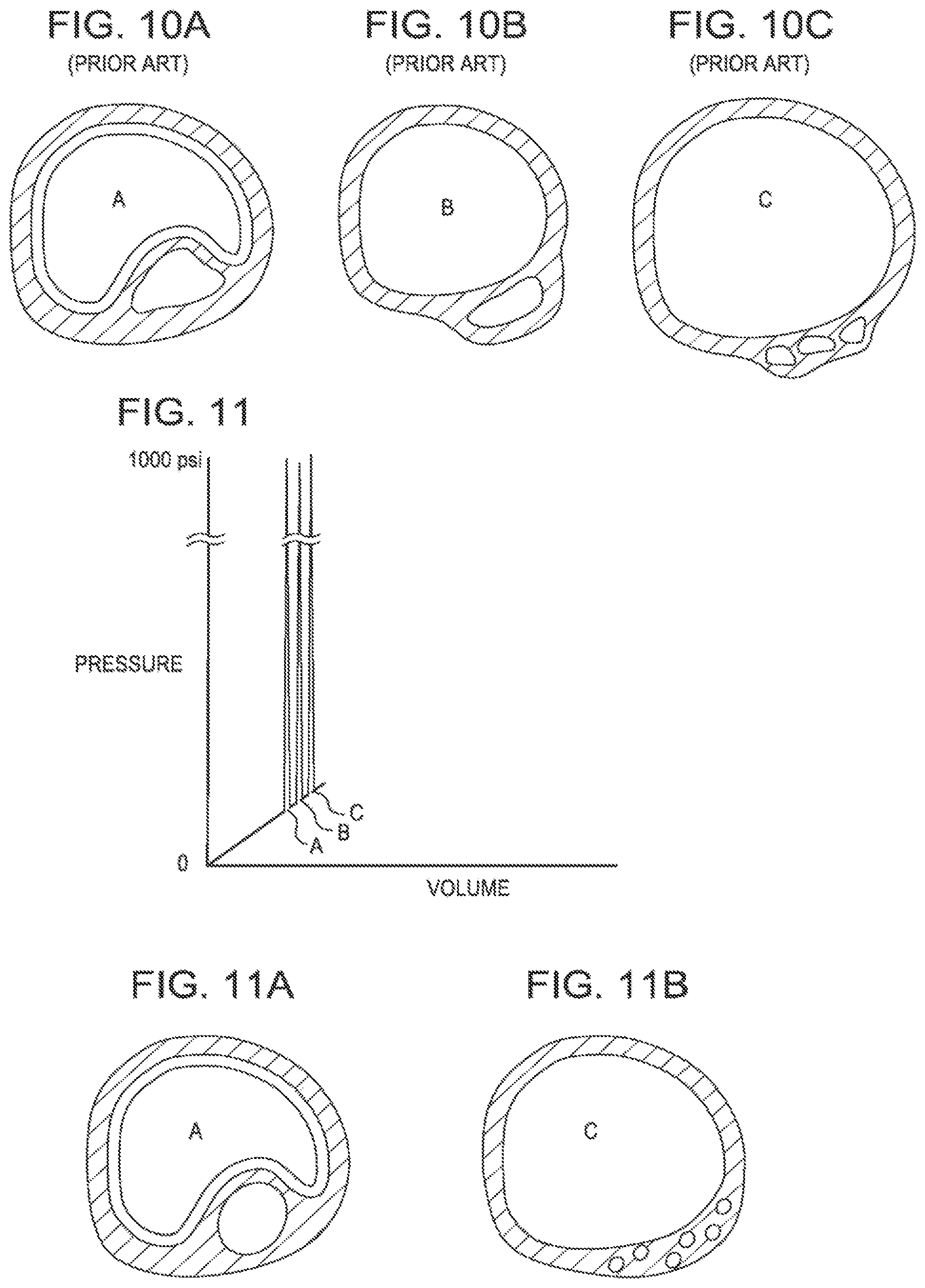 Patent US11771449 Figure 5 – Shockwave balloon catheter system