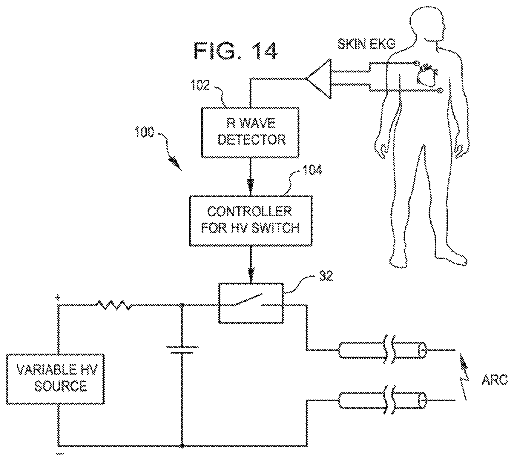Patent US11771449 Figure 7 – Shockwave balloon catheter system