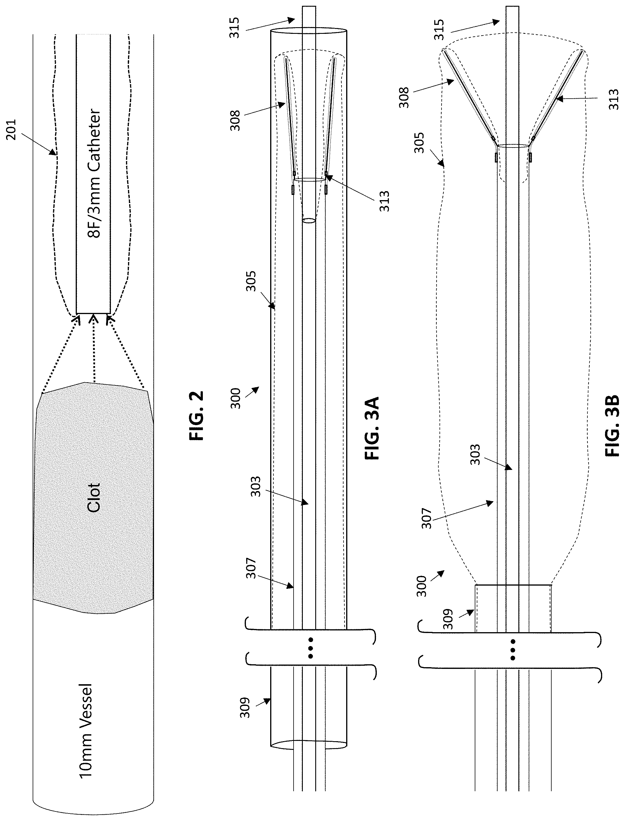 Patent US11771450 Figure 2 – Inverting thrombectomy apparatuses and methods of use