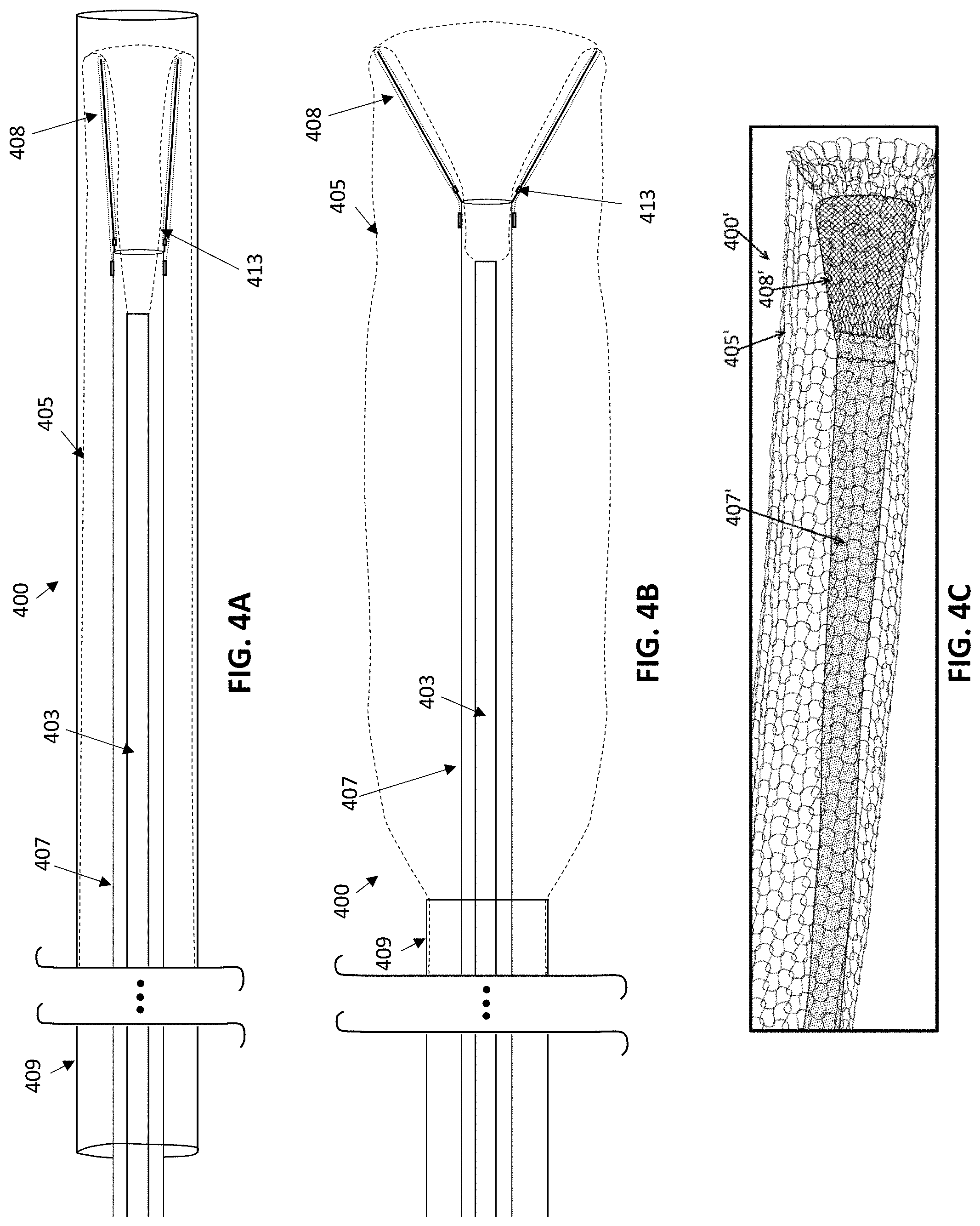 Patent US11771450 Figure 3 – Inverting thrombectomy apparatuses and methods of use