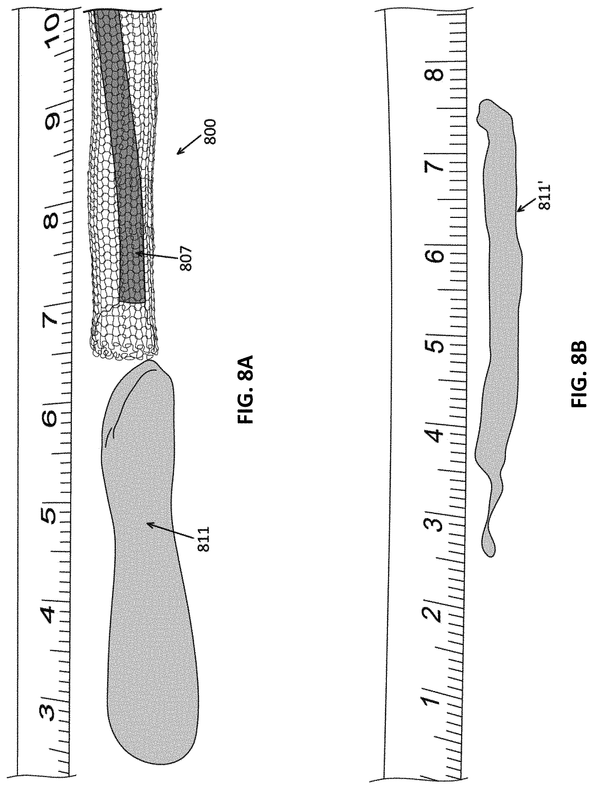 Patent US11771450 Figure 9 – Inverting thrombectomy apparatuses and methods of use