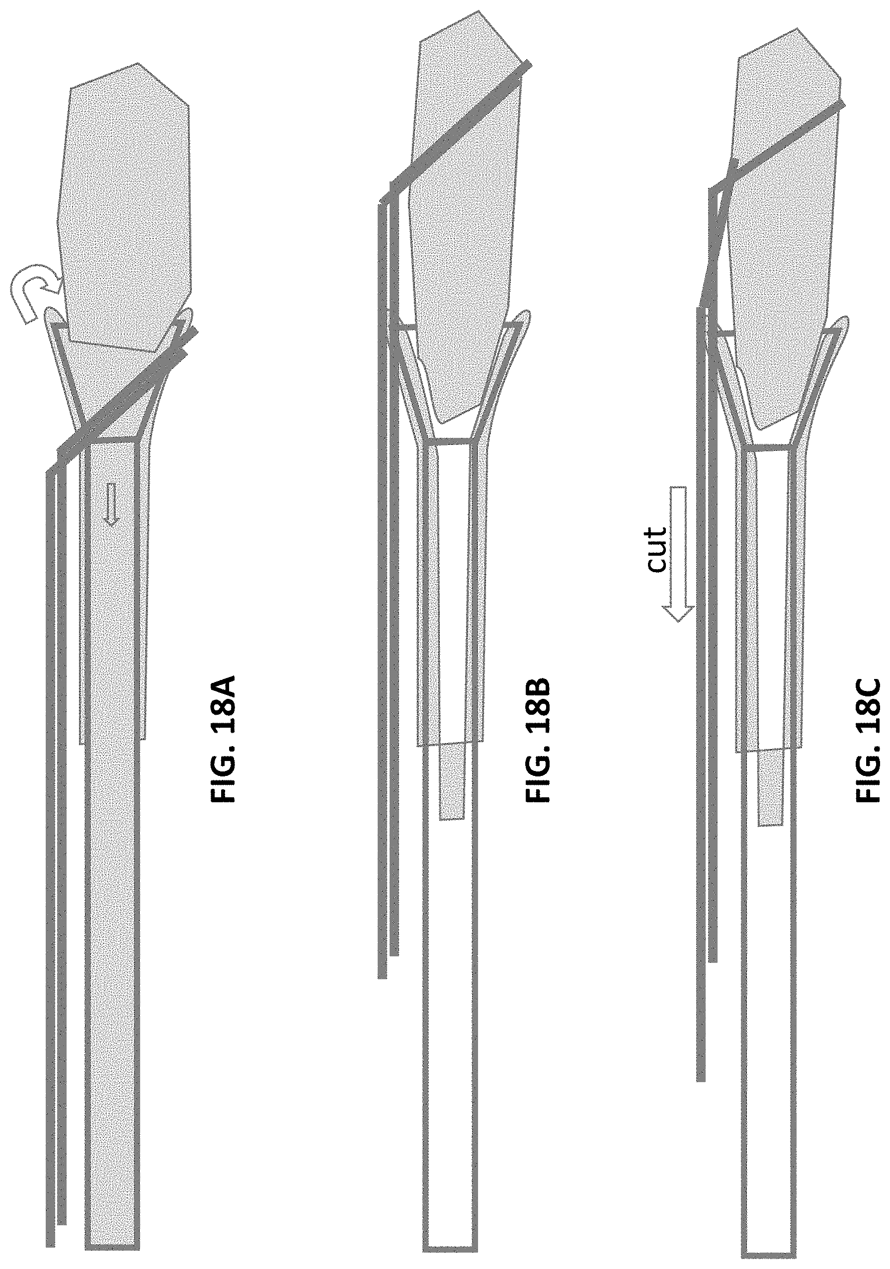 Patent US11771450 Figure 20 – Inverting thrombectomy apparatuses and methods of use