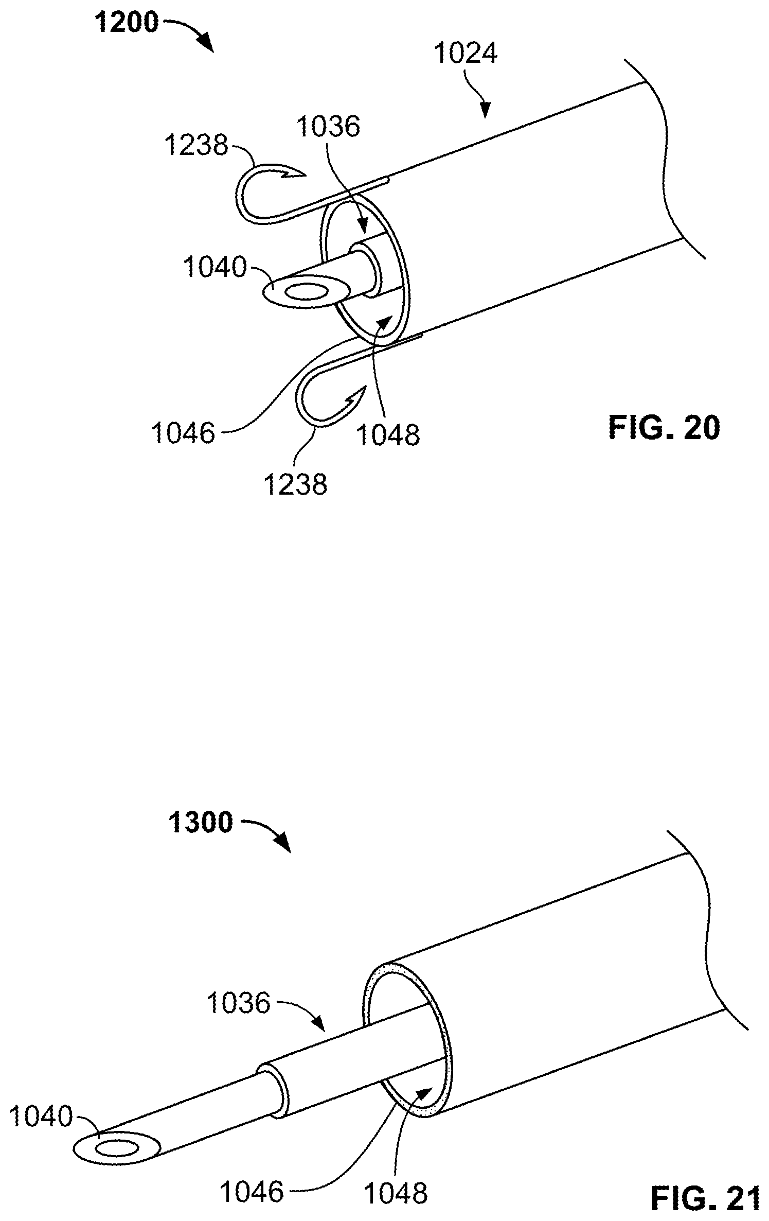 Patent US11771452 Figure 11 – Endoscopic tool for facilitating injection of a fluid into a submucosal layer of tissue