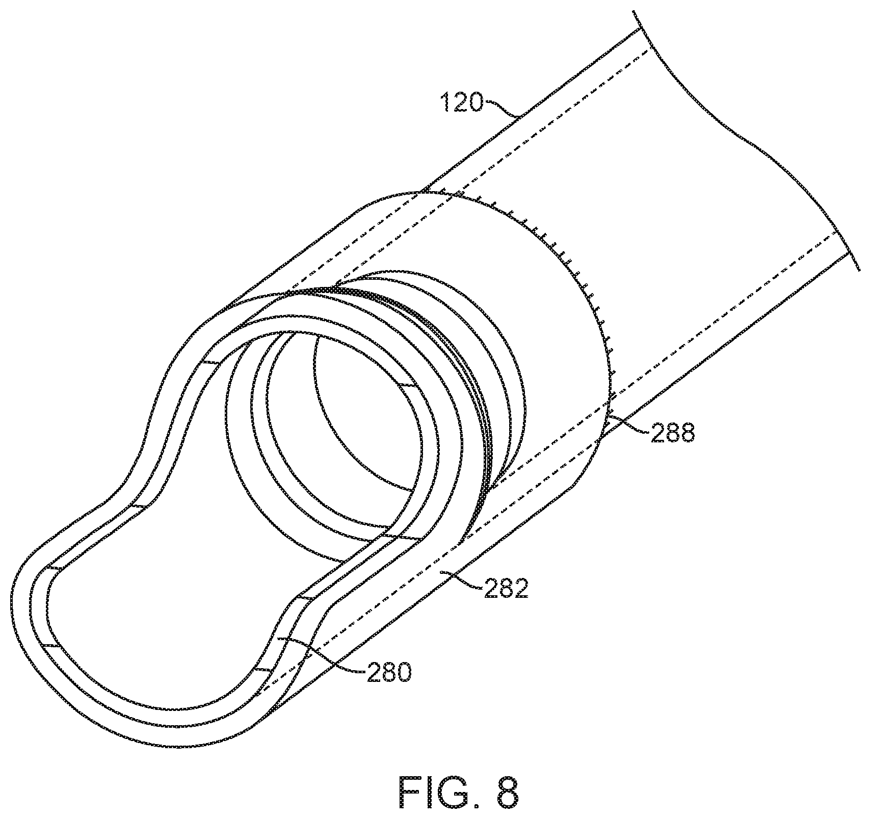 Patent US11771456 Figure 8 – Arthroscopic devices and methods
