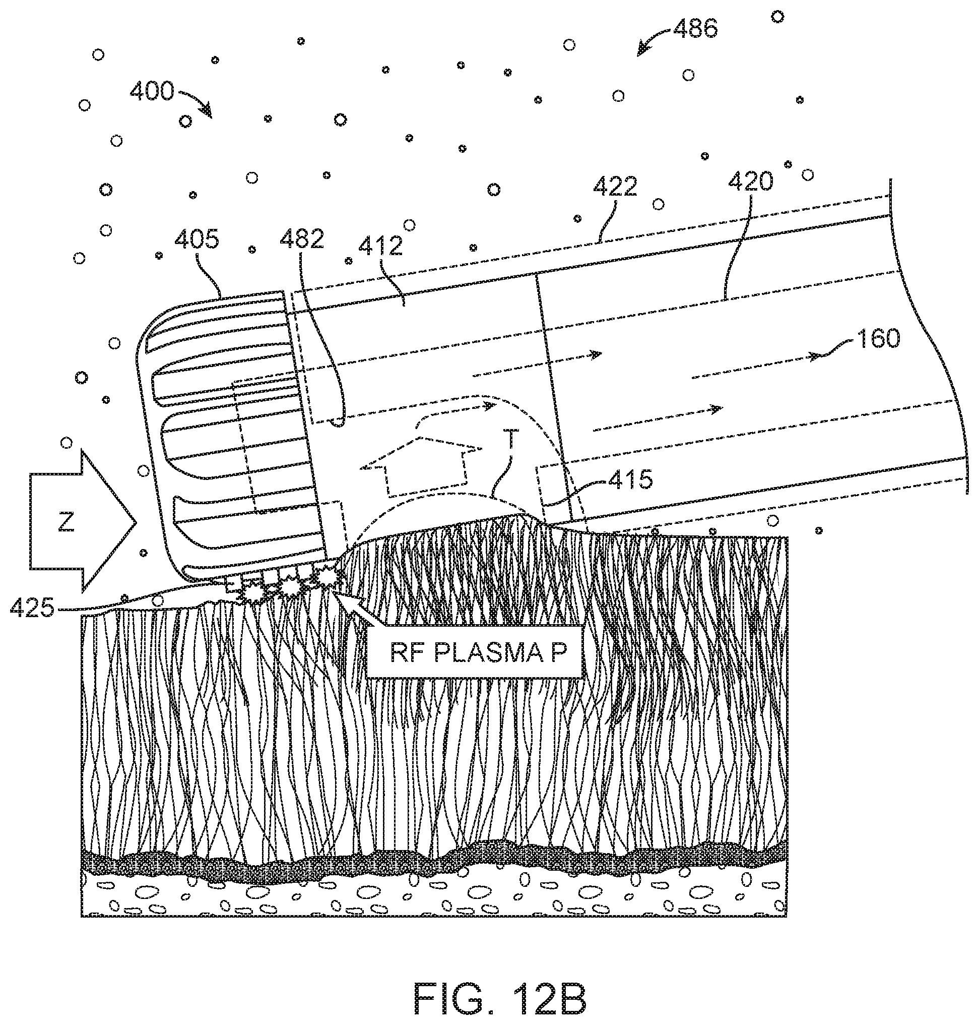 Patent US11771456 Figure 13 – Arthroscopic devices and methods