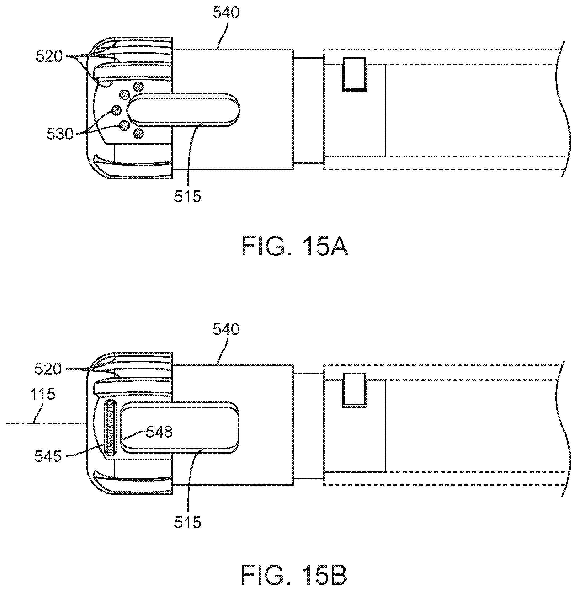 Patent US11771456 Figure 17 – Arthroscopic devices and methods