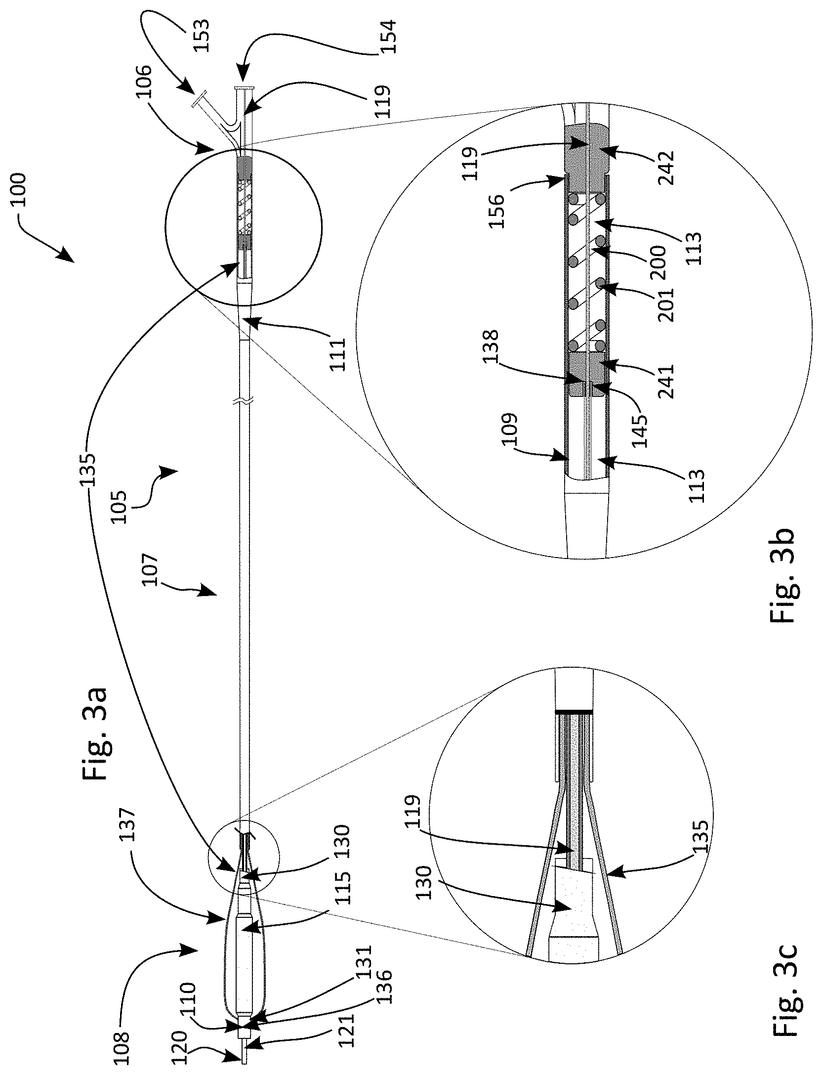Patent US11771457 Figure 3 – Scoring balloon with translating scoring wires