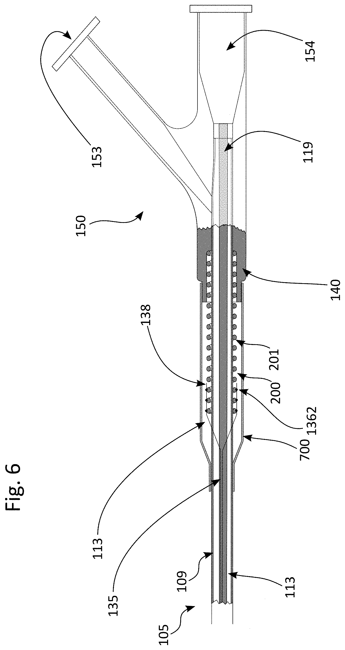 Patent US11771457 Figure 6 – Scoring balloon with translating scoring wires
