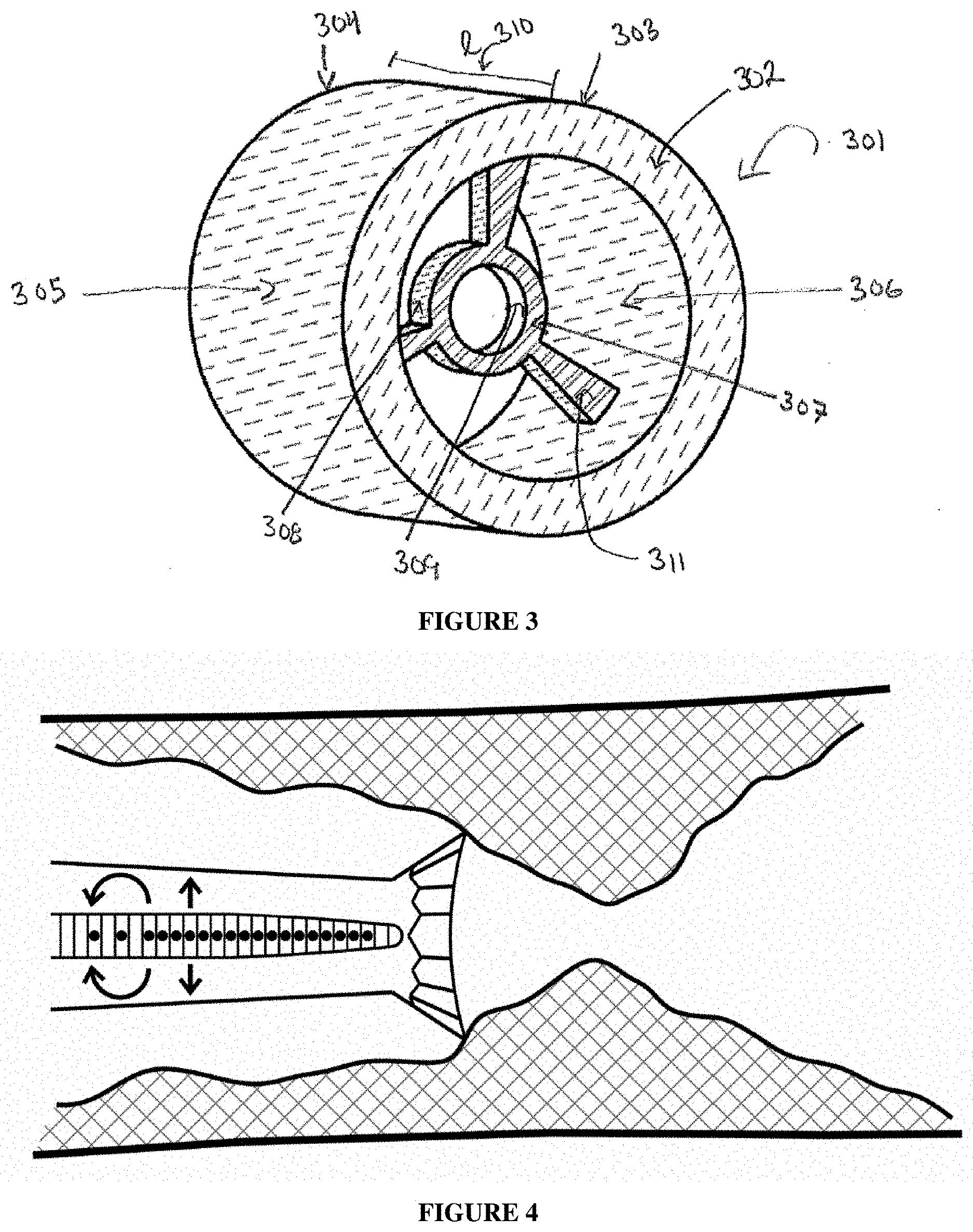 Patent US11771458 Figure 3 – Rotary embolectomy device