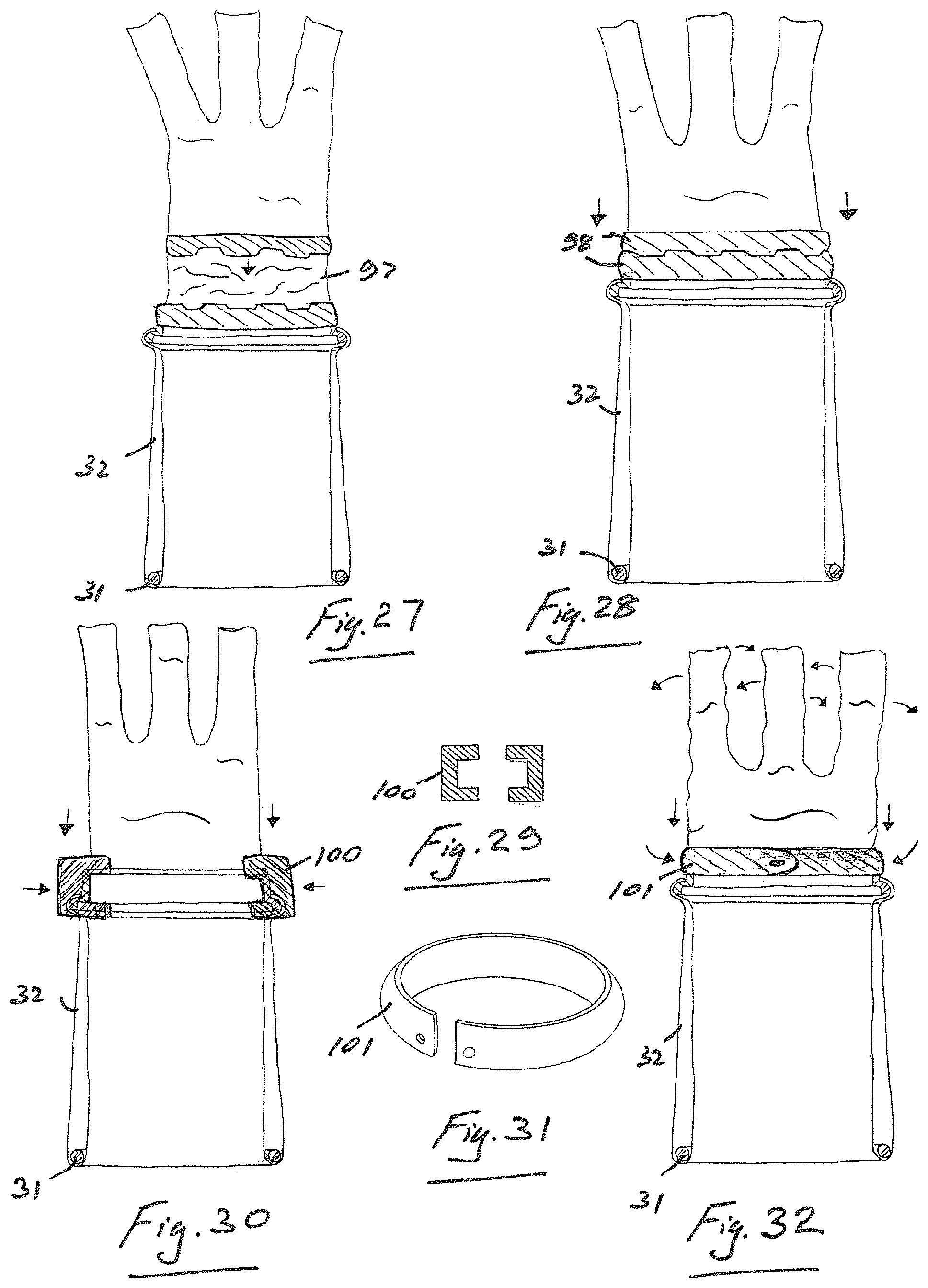Patent US11771460 Figure 14 – Access port device