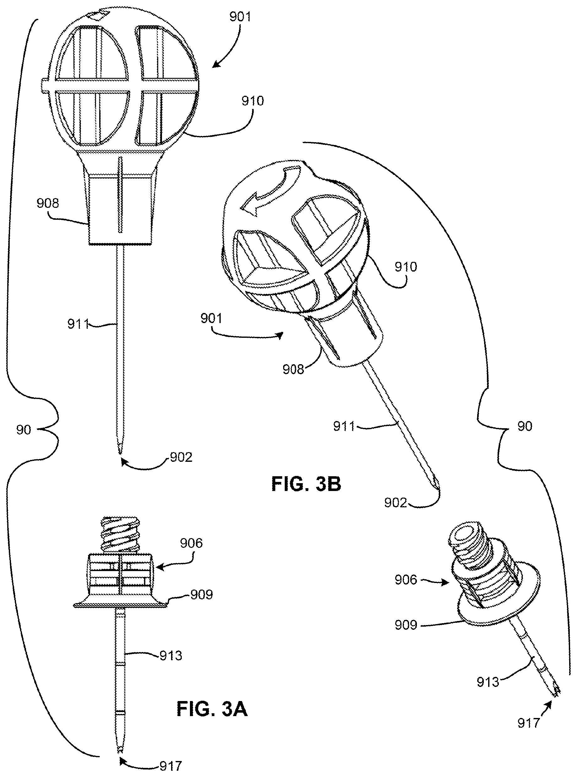 Patent US11771462 Figure 2 – Sternal locators and associated systems and methods
