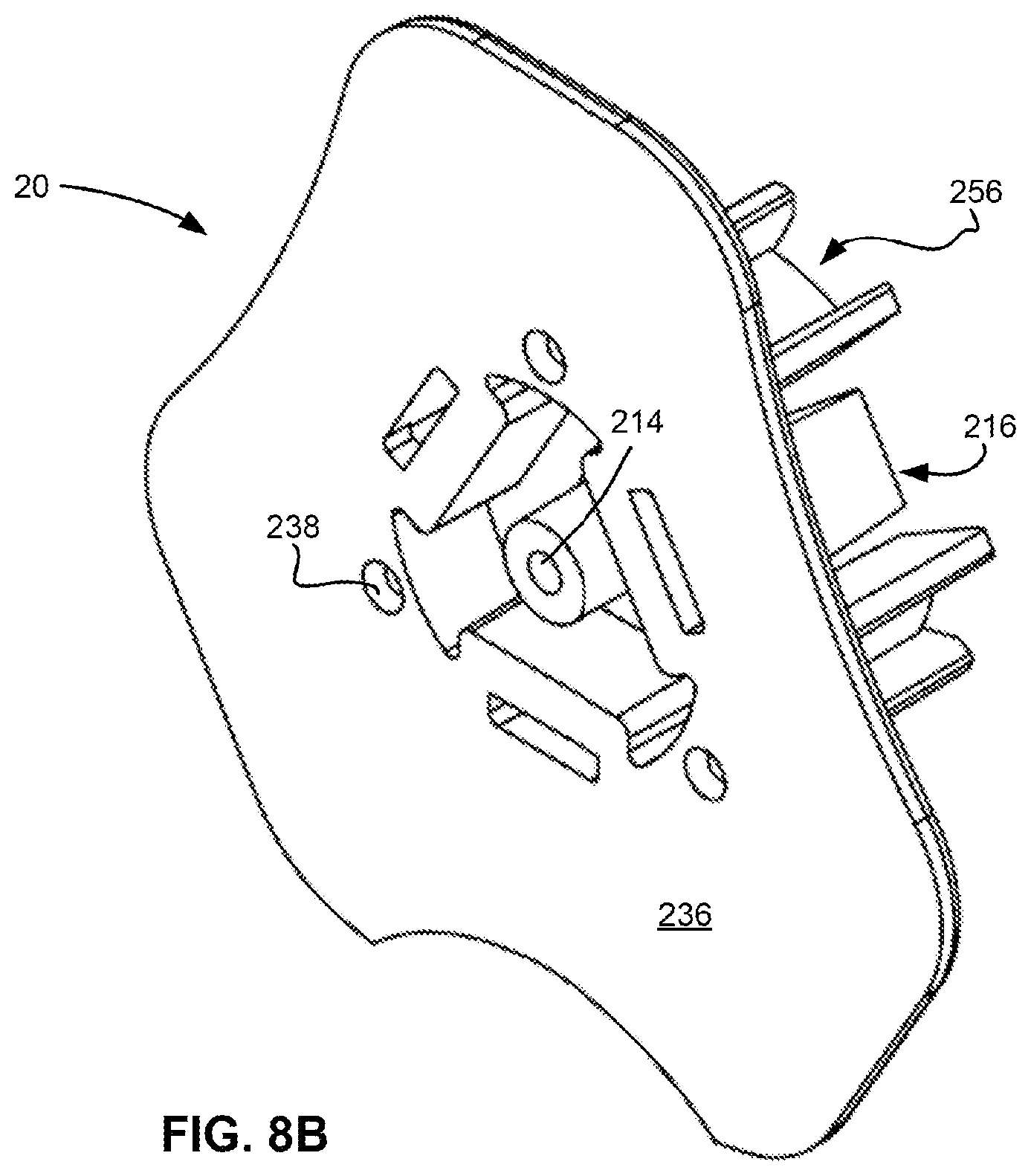 Patent US11771462 Figure 11 – Sternal locators and associated systems and methods