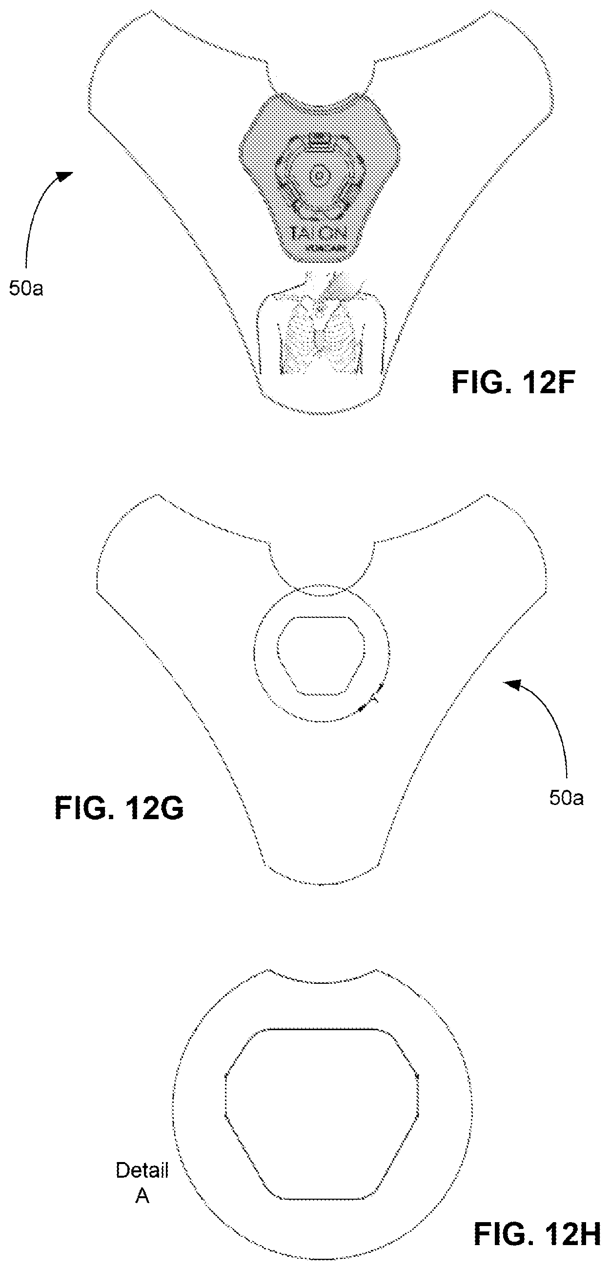 Patent US11771462 Figure 15 – Sternal locators and associated systems and methods