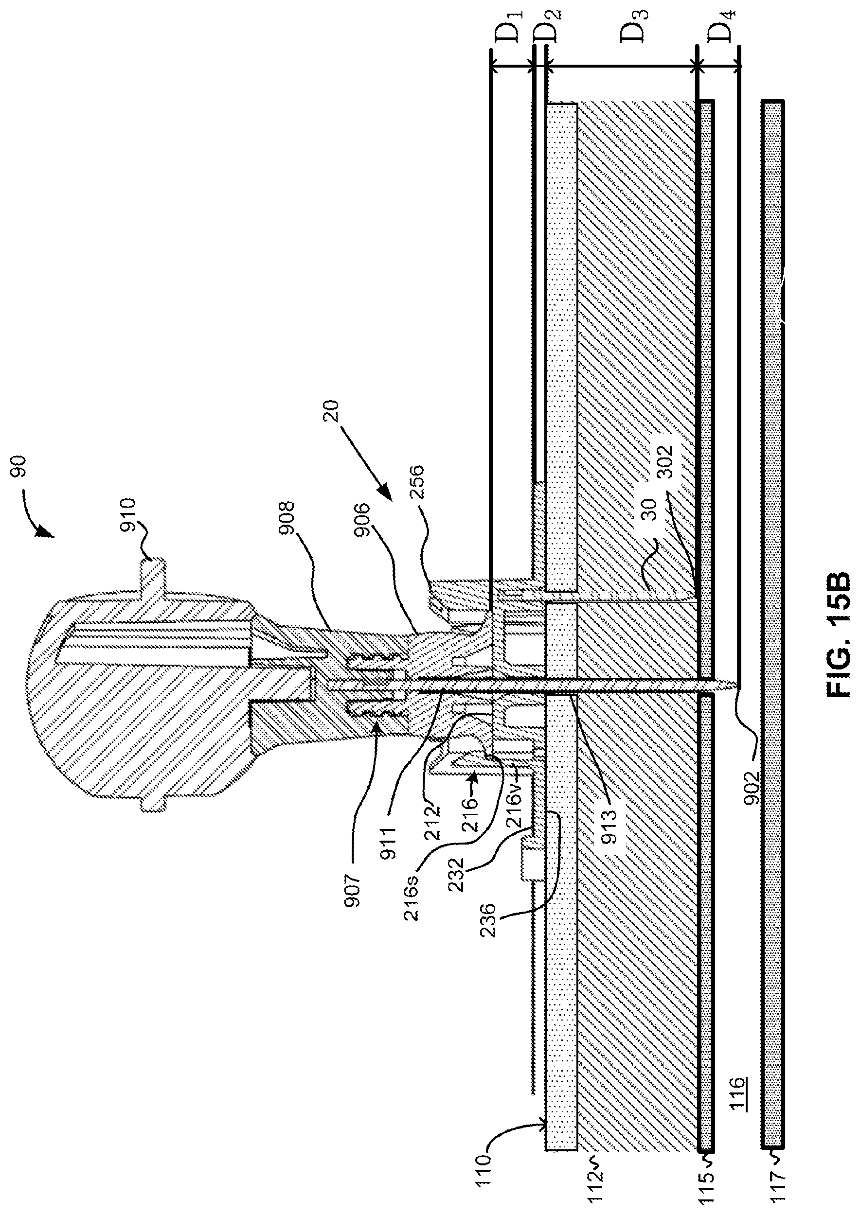 Patent US11771462 Figure 20 – Sternal locators and associated systems and methods