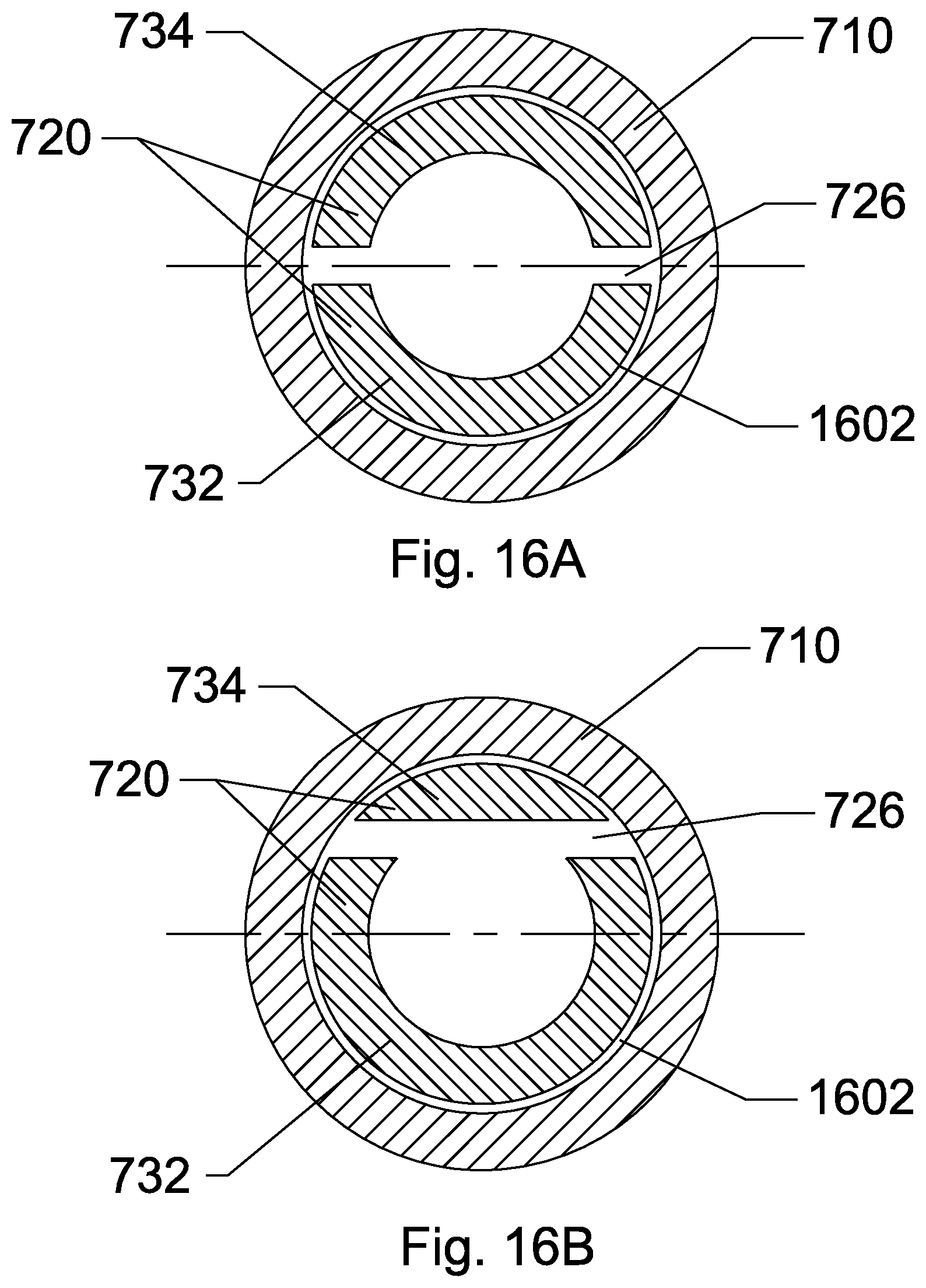 Patent US11771463 Figure 16 – Steerable endoluminal punch