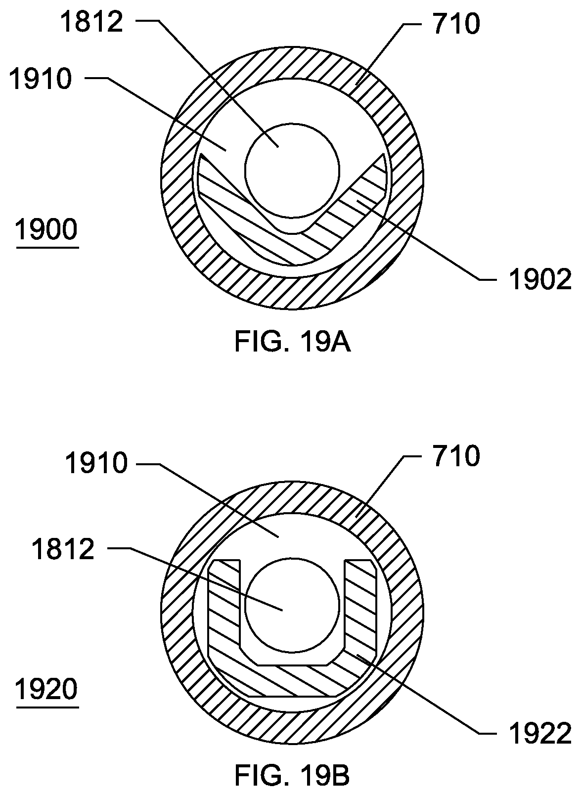 Patent US11771463 Figure 19 – Steerable endoluminal punch
