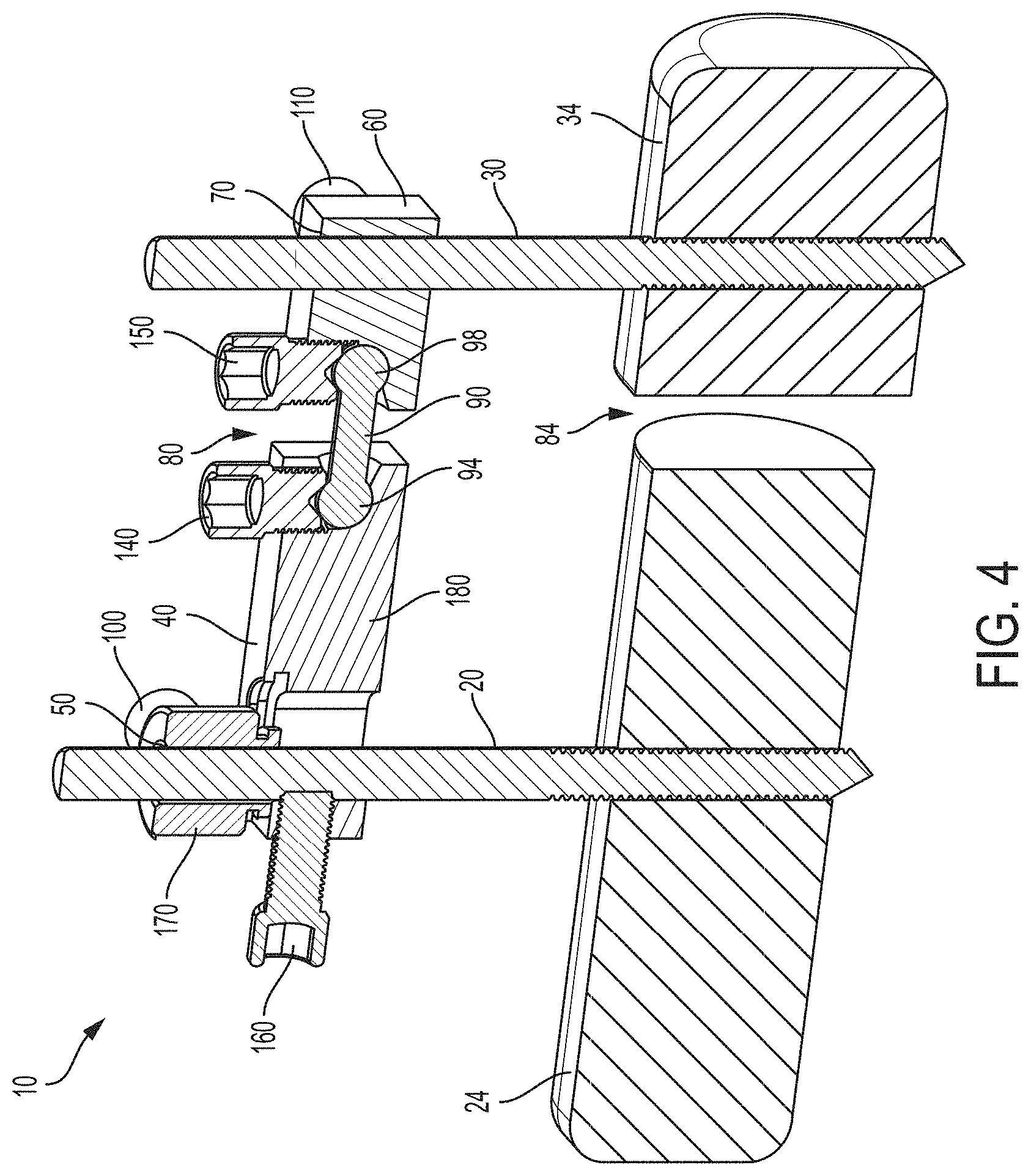 Patent US11771467 Figure 4 – Bone positioning and cutting system and method