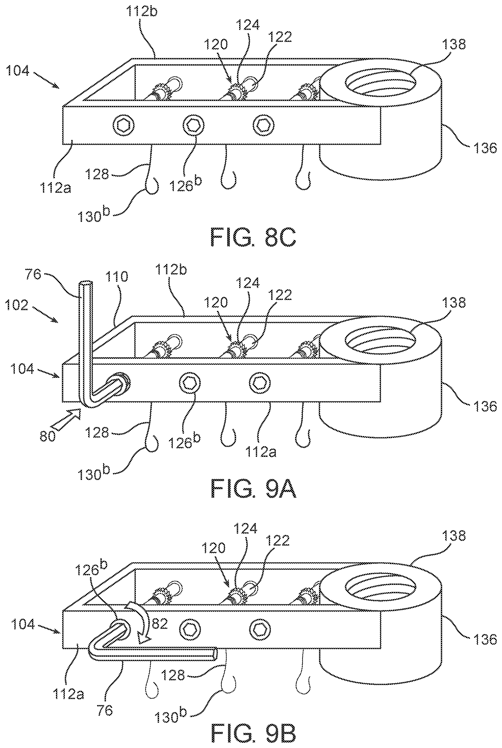 Patent US11771468 Figure 9 – Devices, systems and methods for distraction osteogenesis