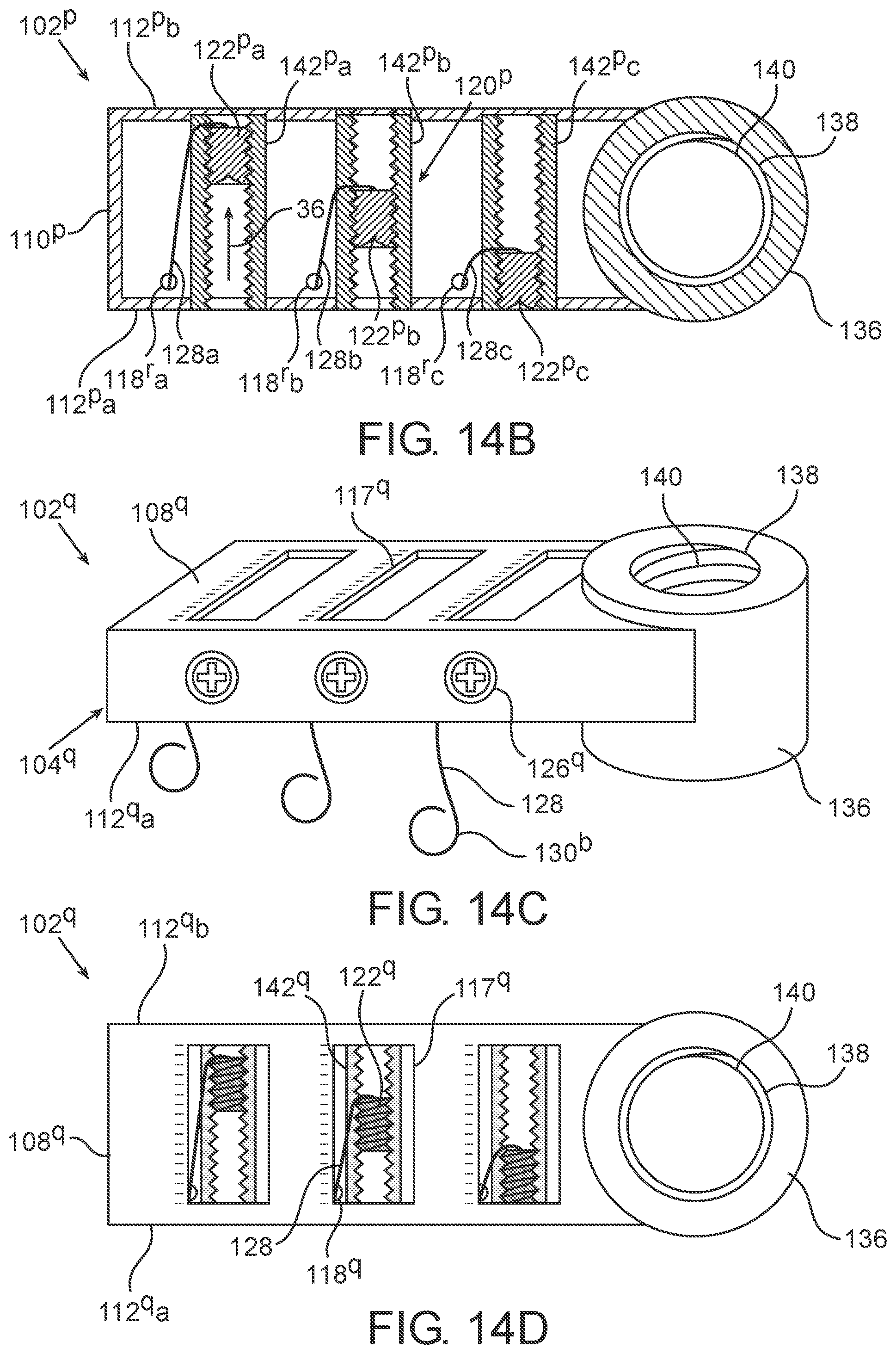 Patent US11771468 Figure 14 – Devices, systems and methods for distraction osteogenesis