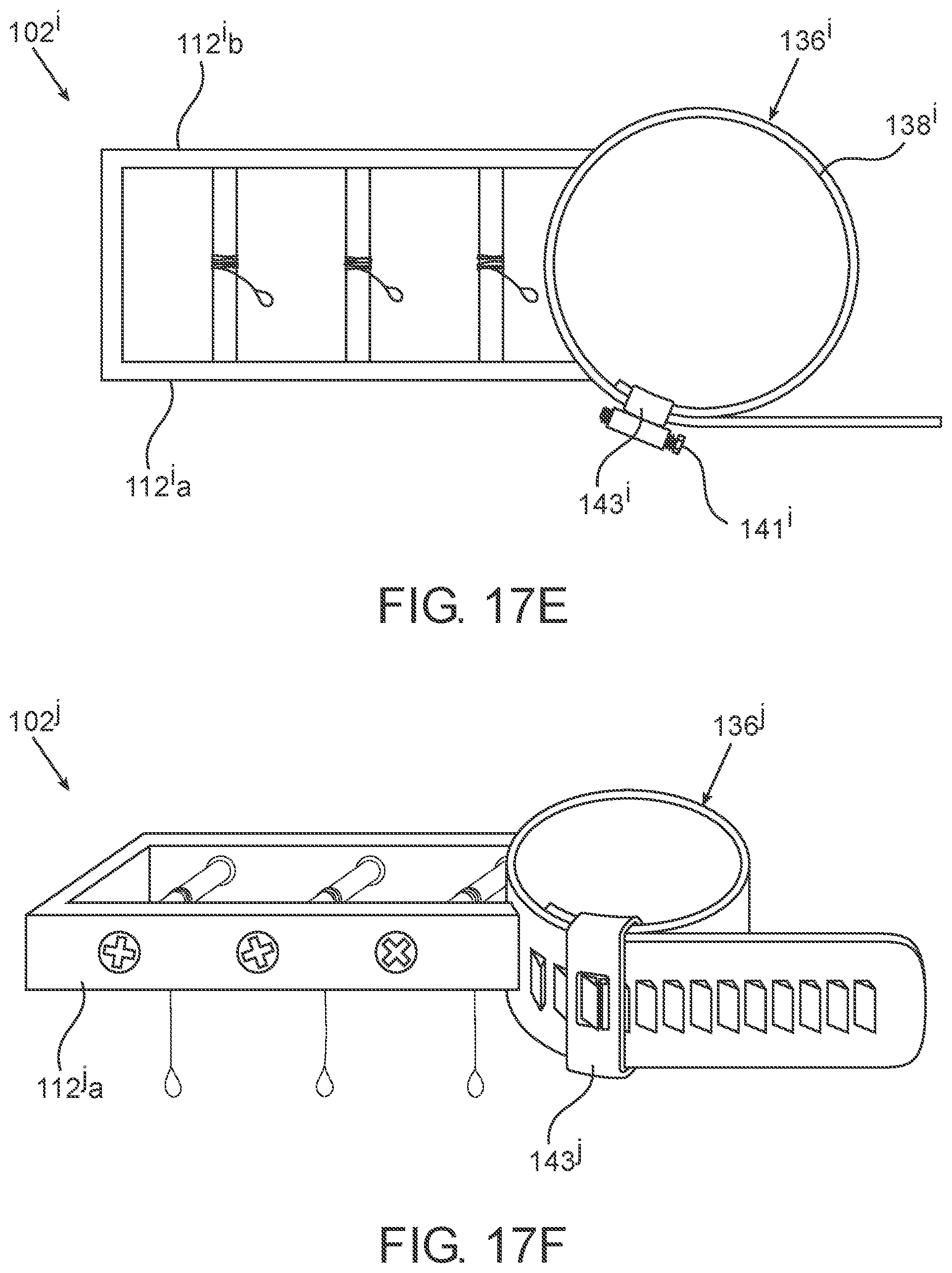 Patent US11771468 Figure 19 – Devices, systems and methods for distraction osteogenesis