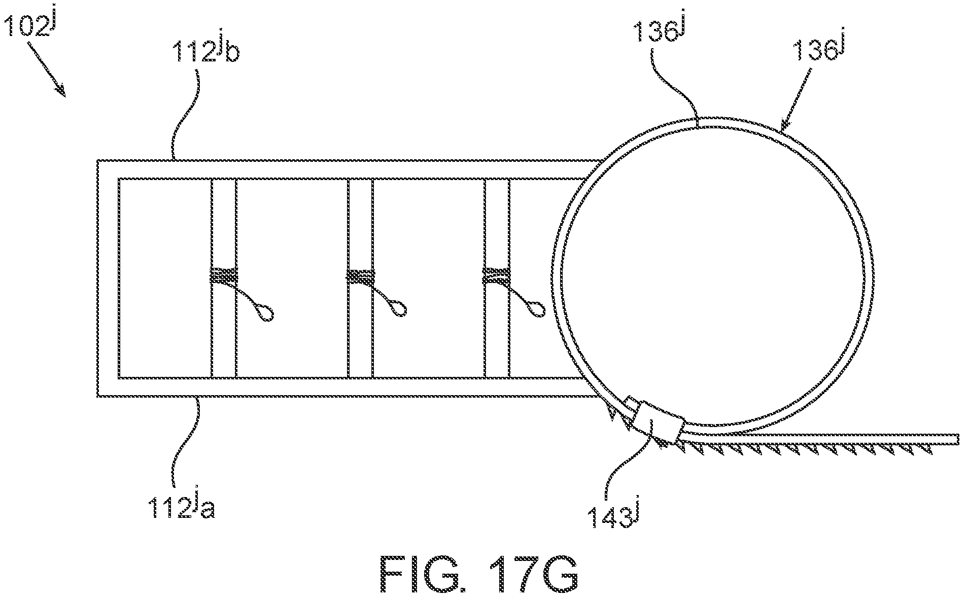 Patent US11771468 Figure 20 – Devices, systems and methods for distraction osteogenesis