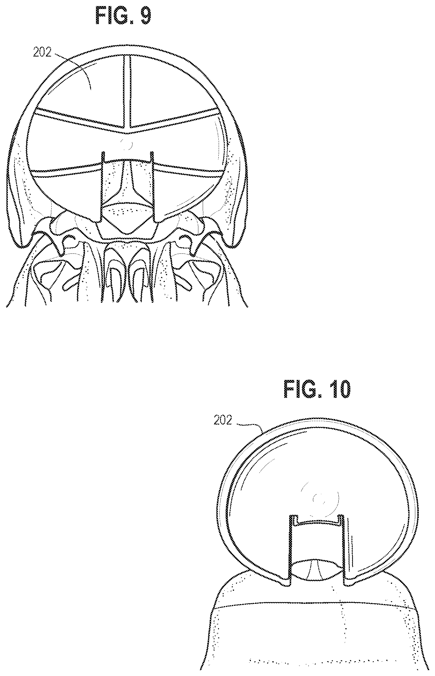 Patent US11771470 Figure 6 – Affixation device for securing bone flap