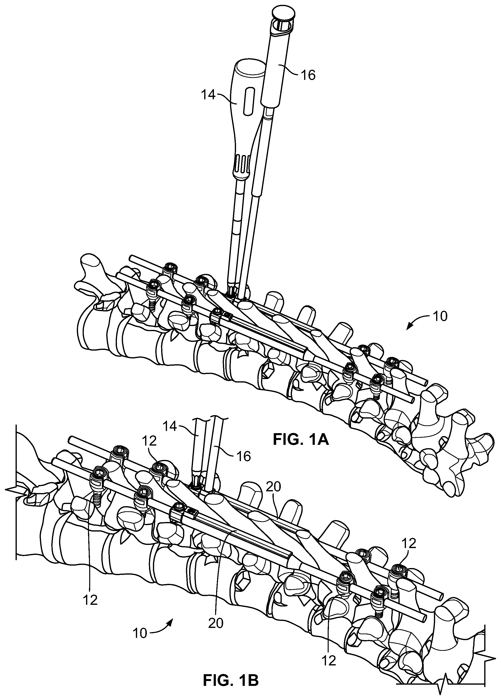 Patent US11771471 Figure 1 – Growing rods and methods of use