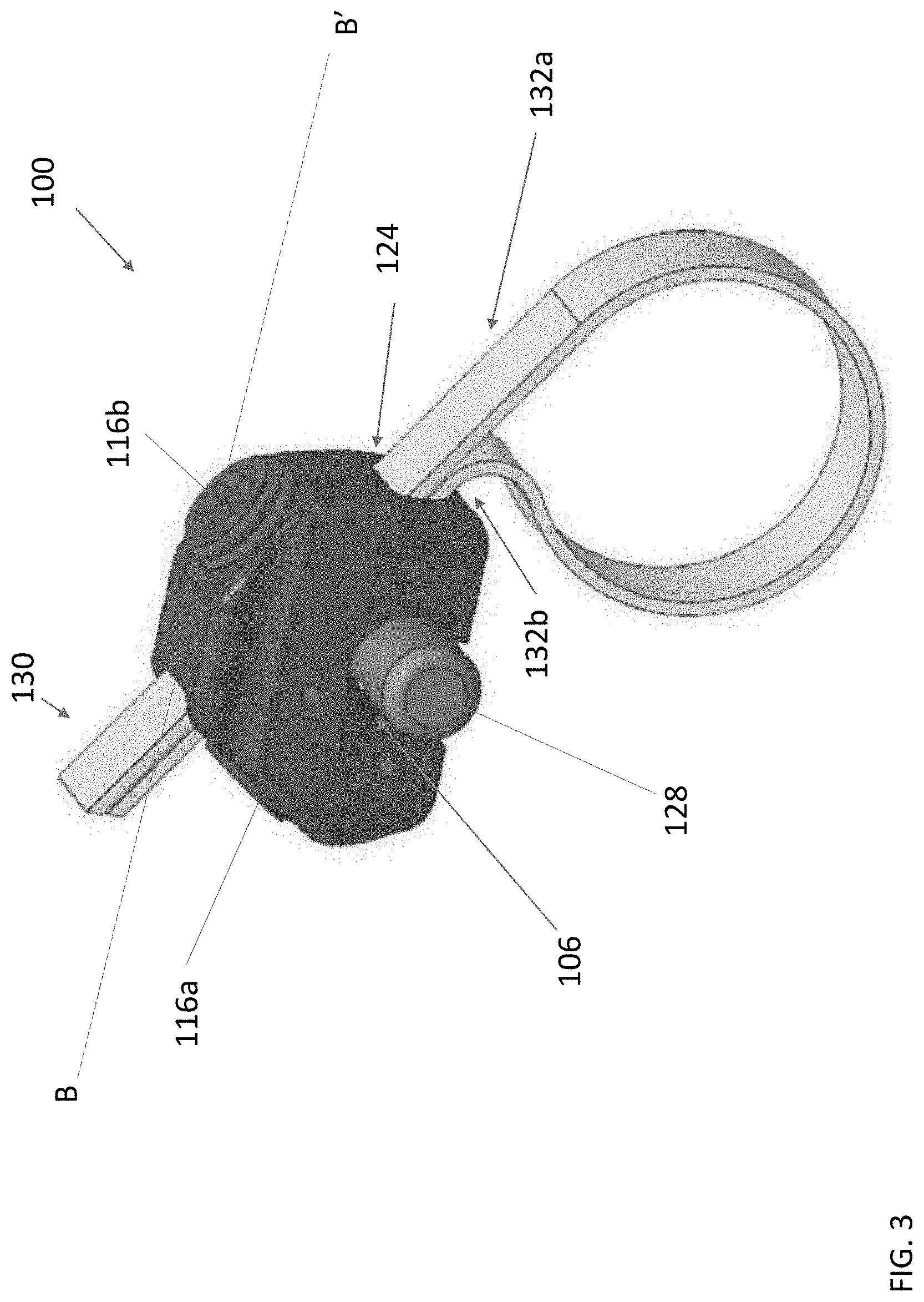 Patent US11771472 Figure 3 – Sublaminar band clamp