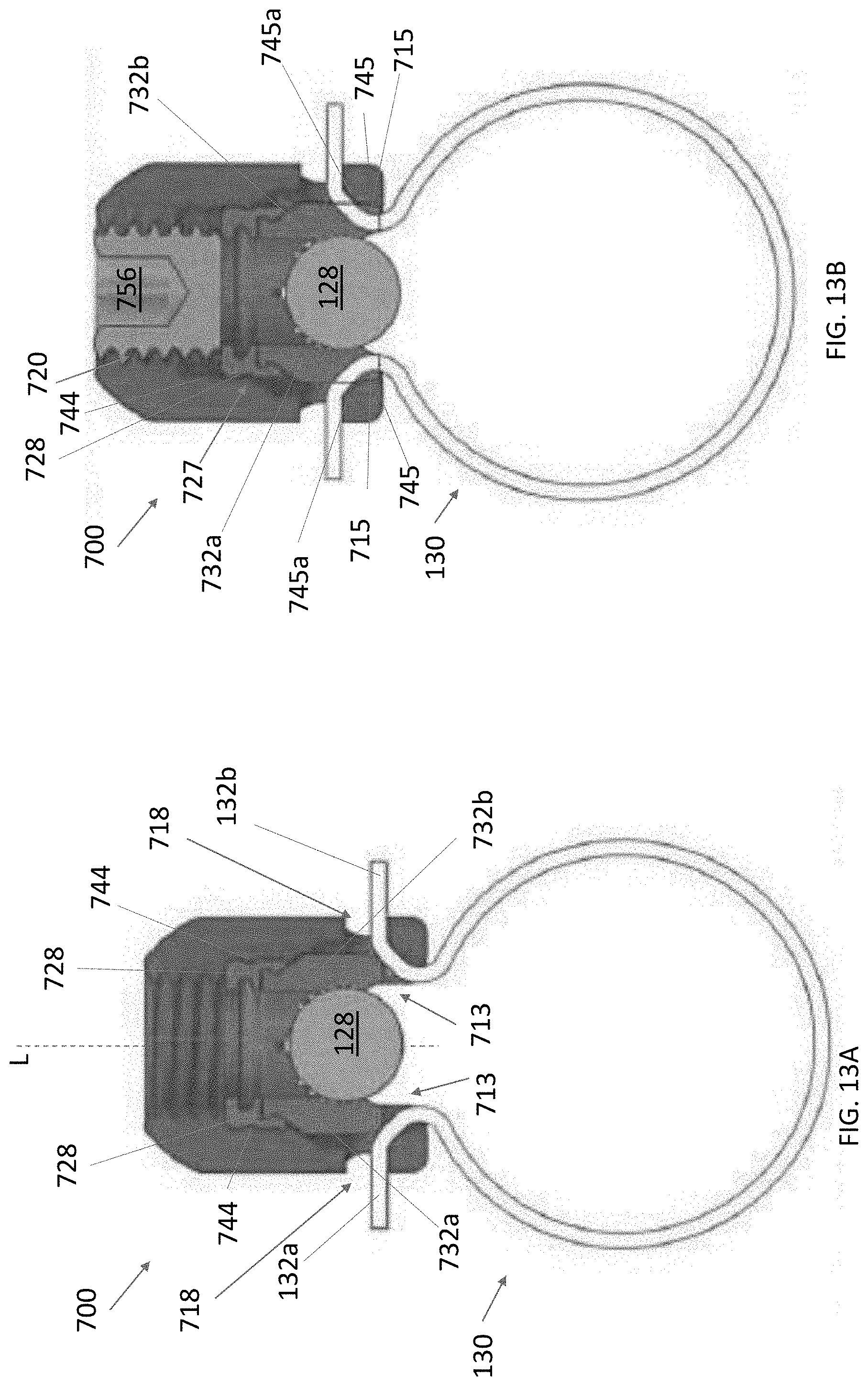 Patent US11771472 Figure 11 – Sublaminar band clamp