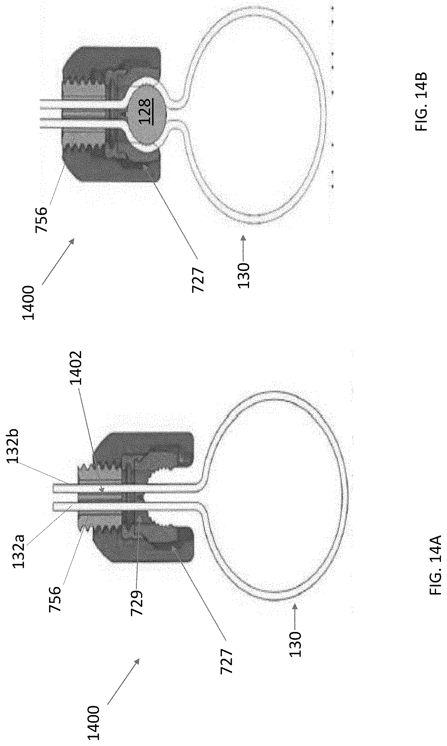 Patent US11771472 Figure 12 – Sublaminar band clamp