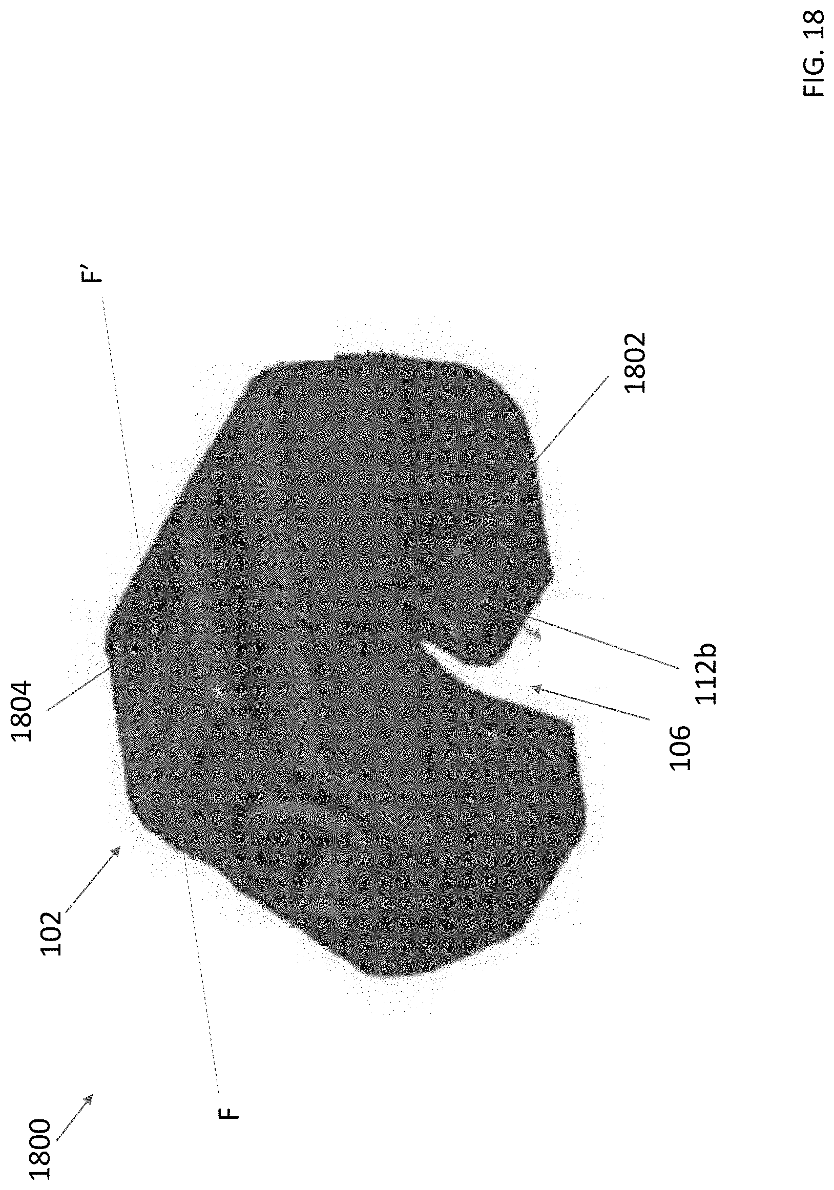 Patent US11771472 Figure 16 – Sublaminar band clamp