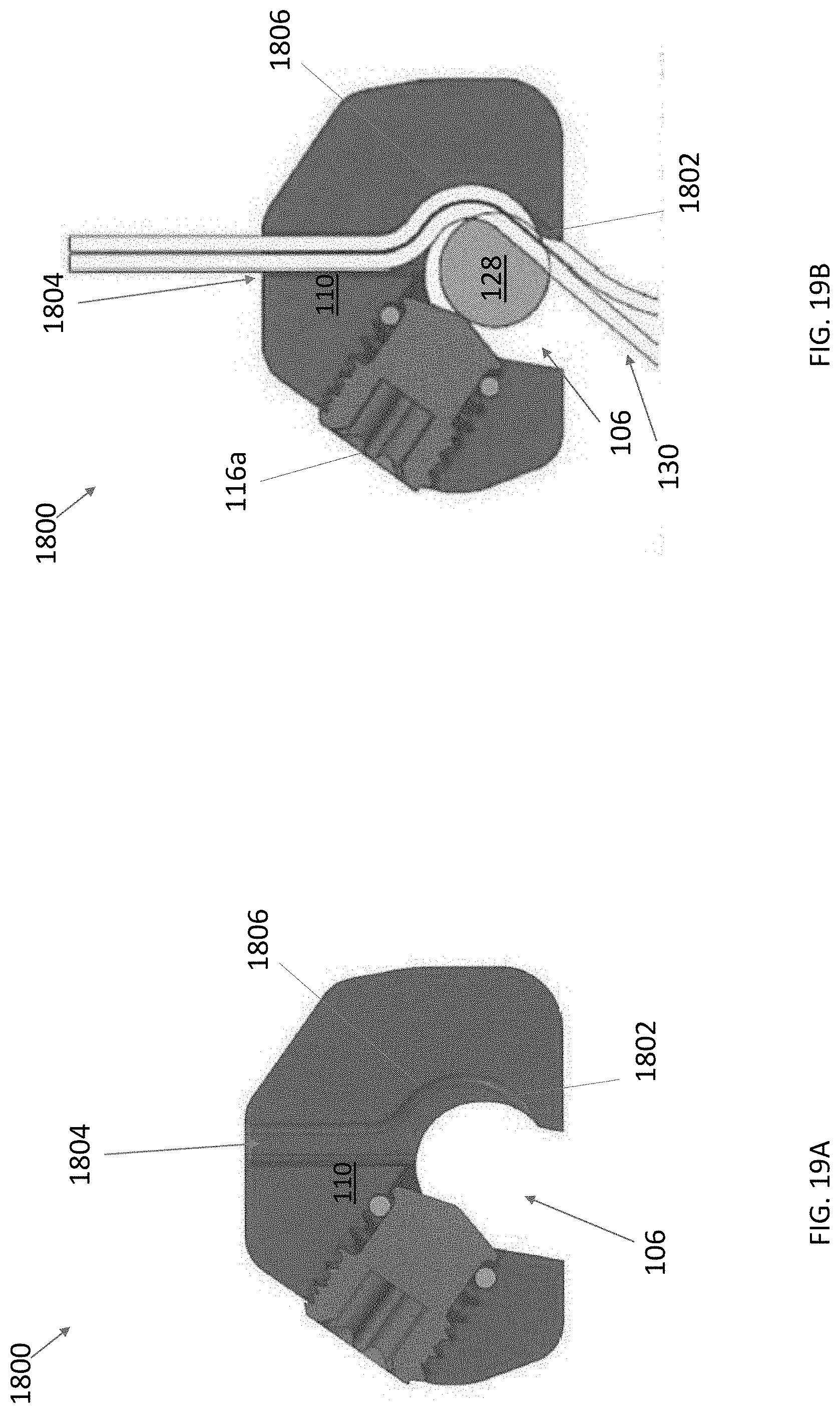 Patent US11771472 Figure 17 – Sublaminar band clamp
