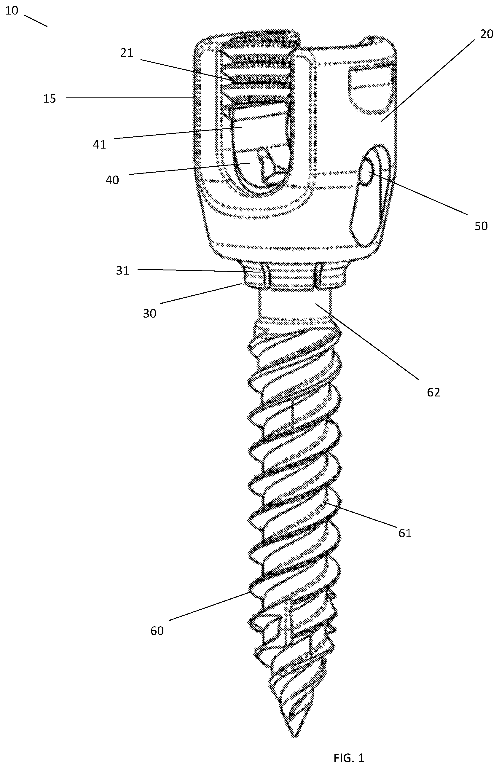 Patent US11771473 Figure 1 – Polyaxial pedicle screw
