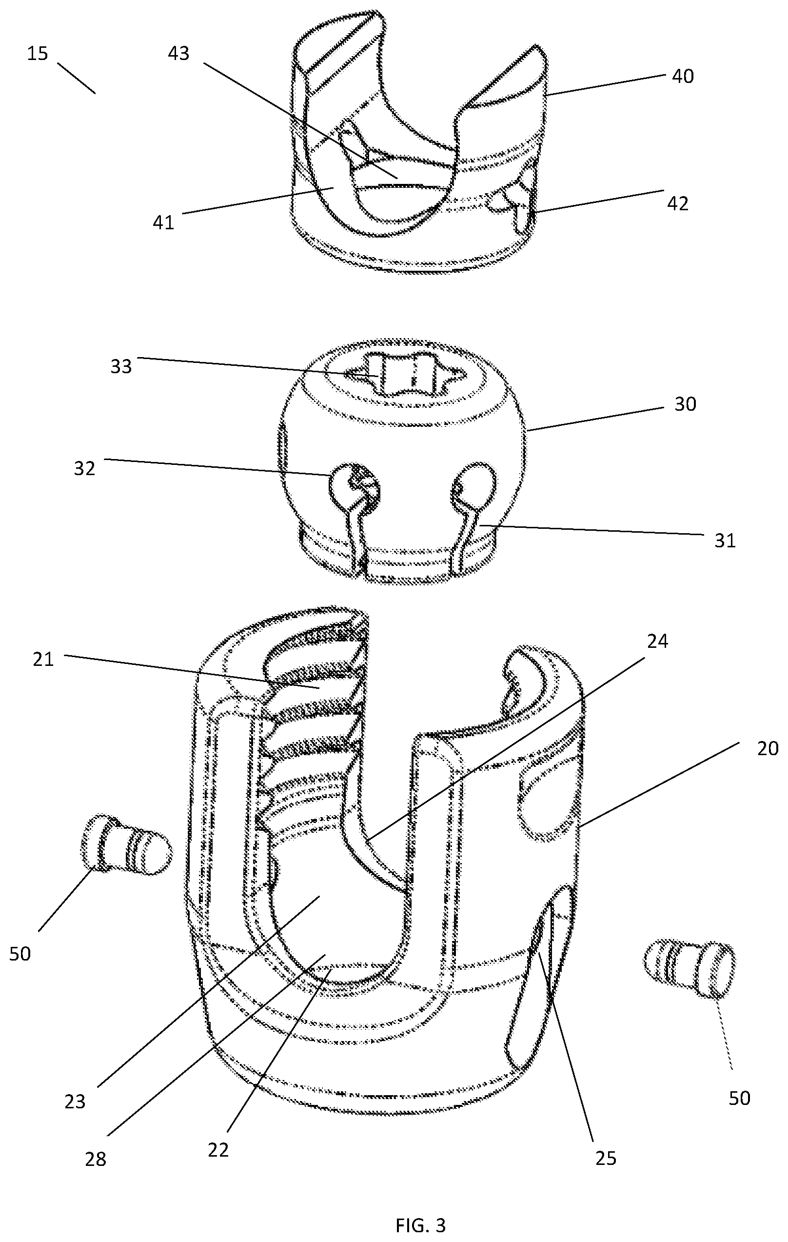 Patent US11771473 Figure 3 – Polyaxial pedicle screw