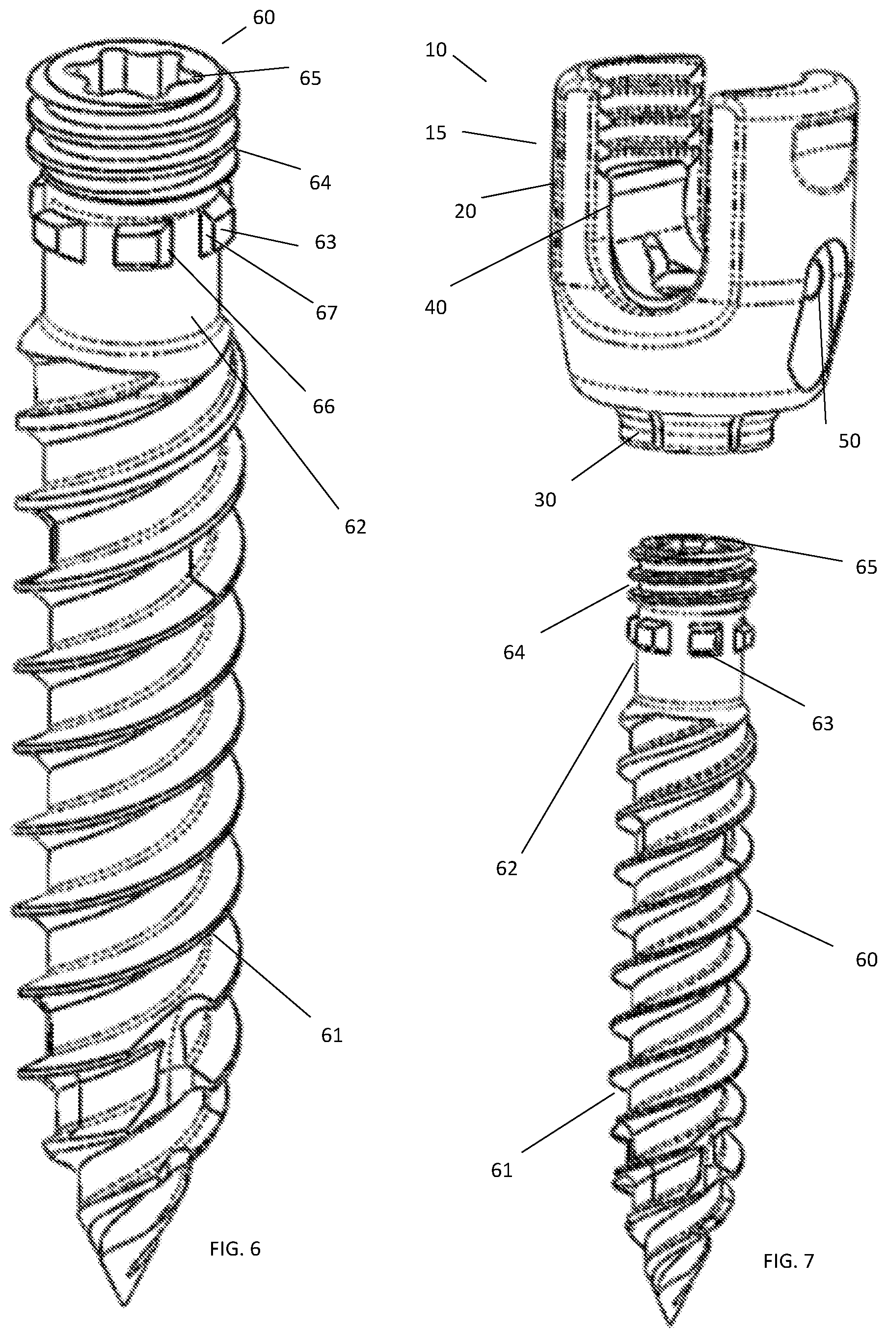 Patent US11771473 Figure 5 – Polyaxial pedicle screw