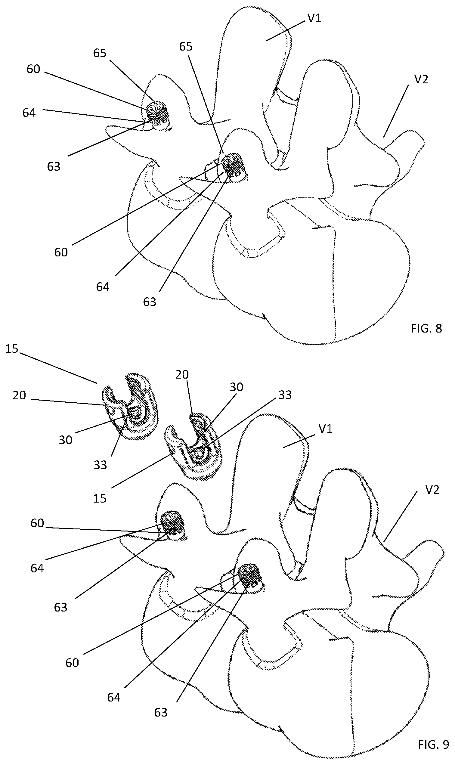 Patent US11771473 Figure 6 – Polyaxial pedicle screw