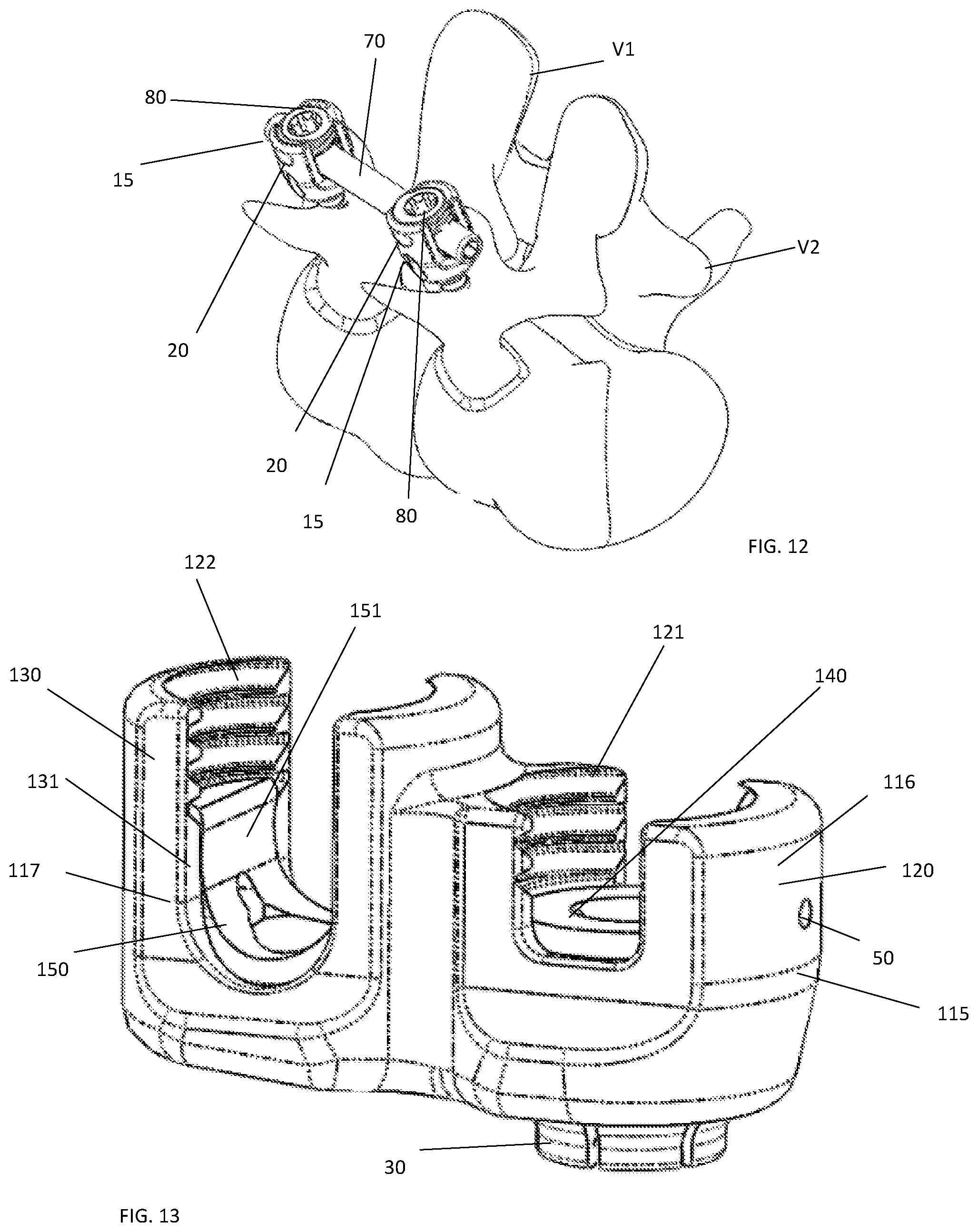 Patent US11771473 Figure 8 – Polyaxial pedicle screw