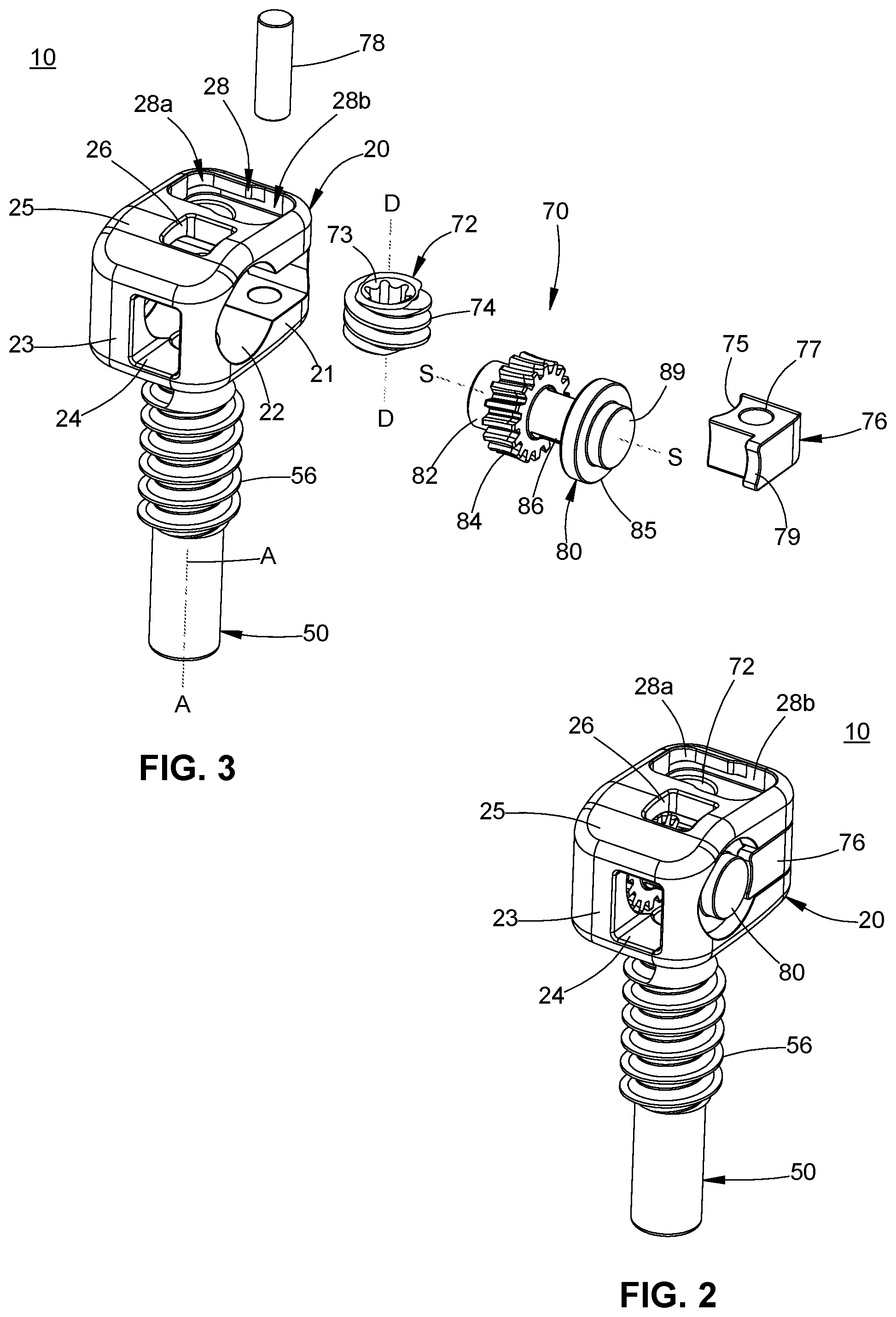 Patent US11771474 Figure 2 – Band tensioning system